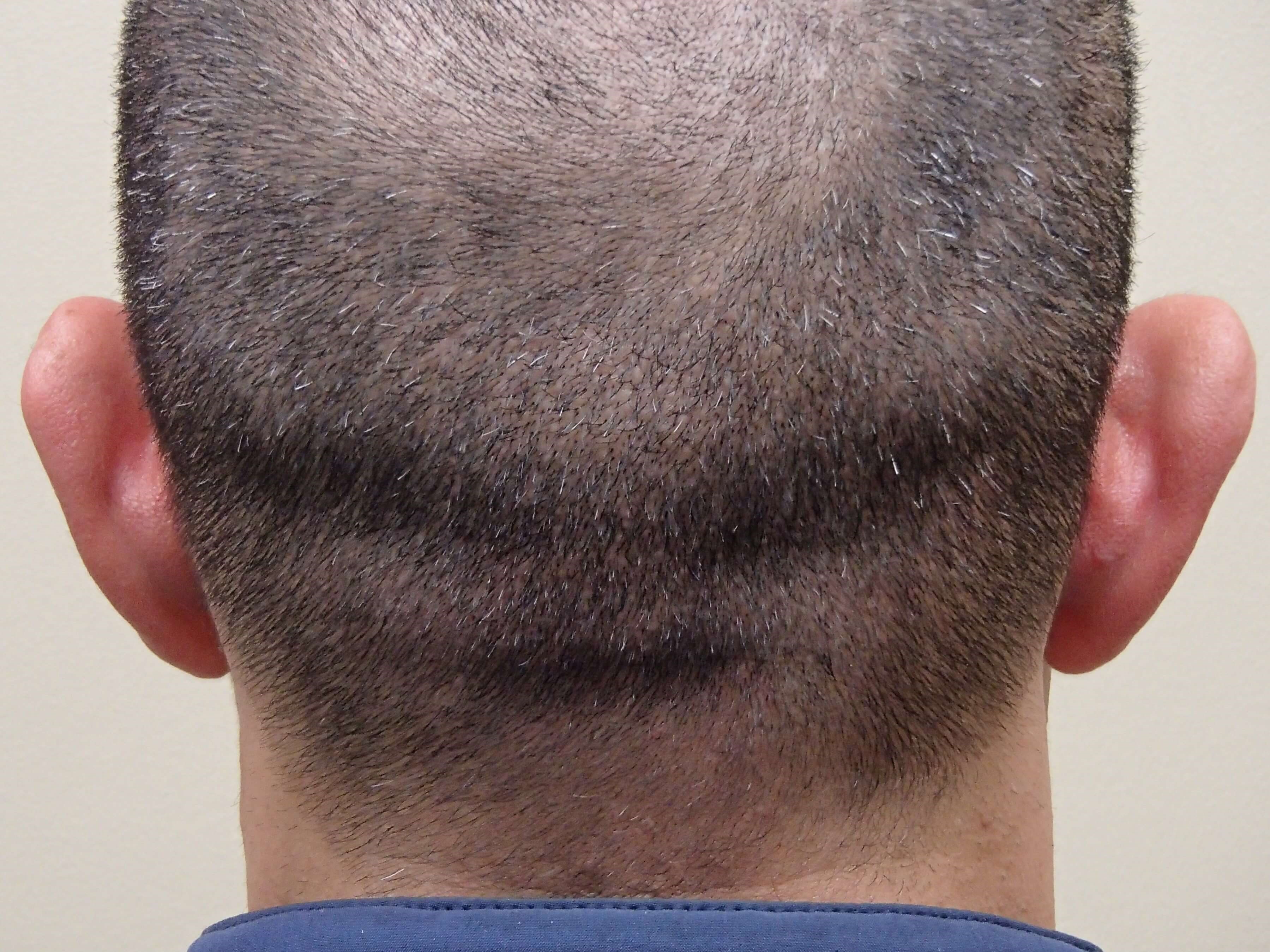 Before Image