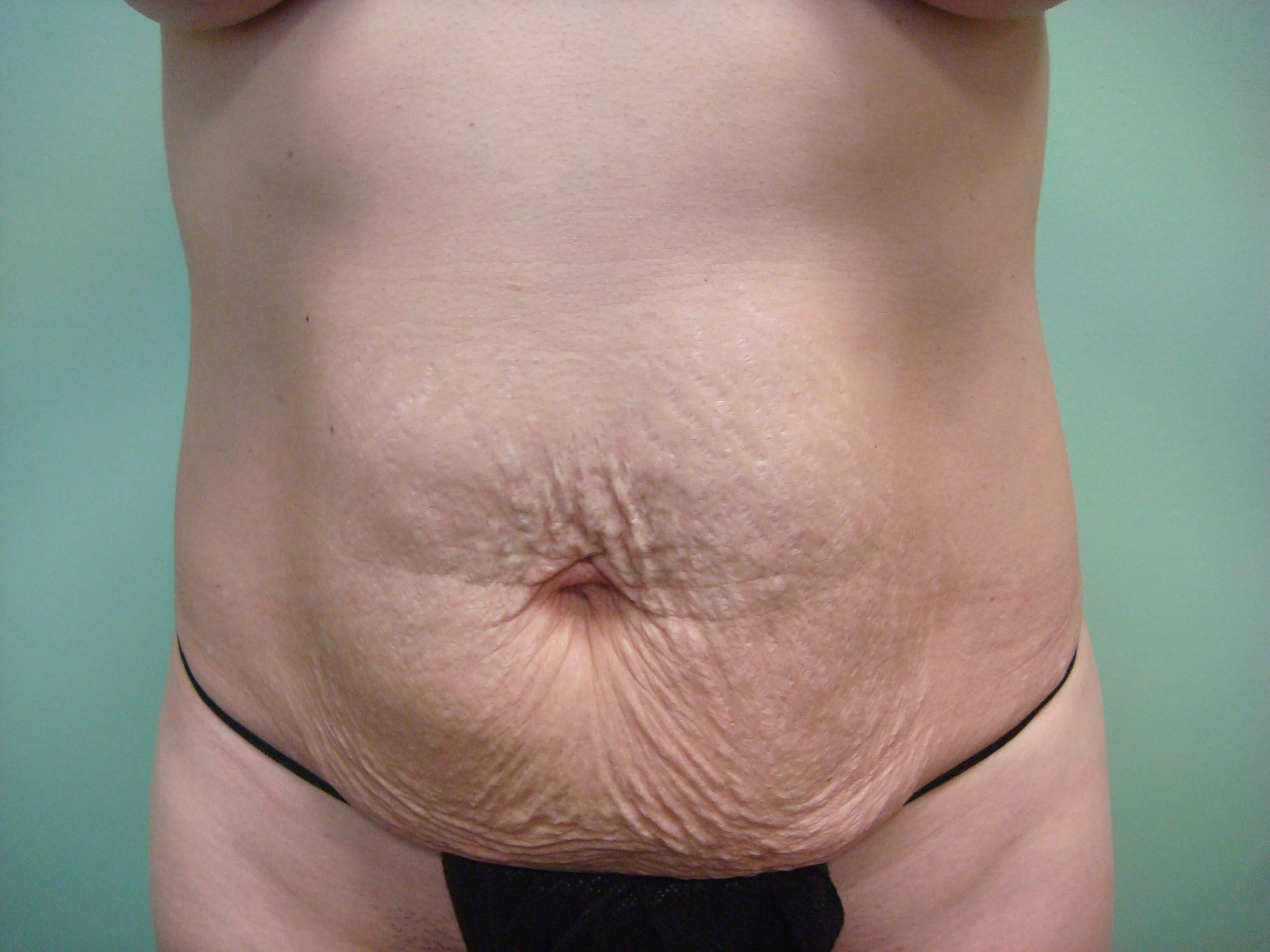 Before Image