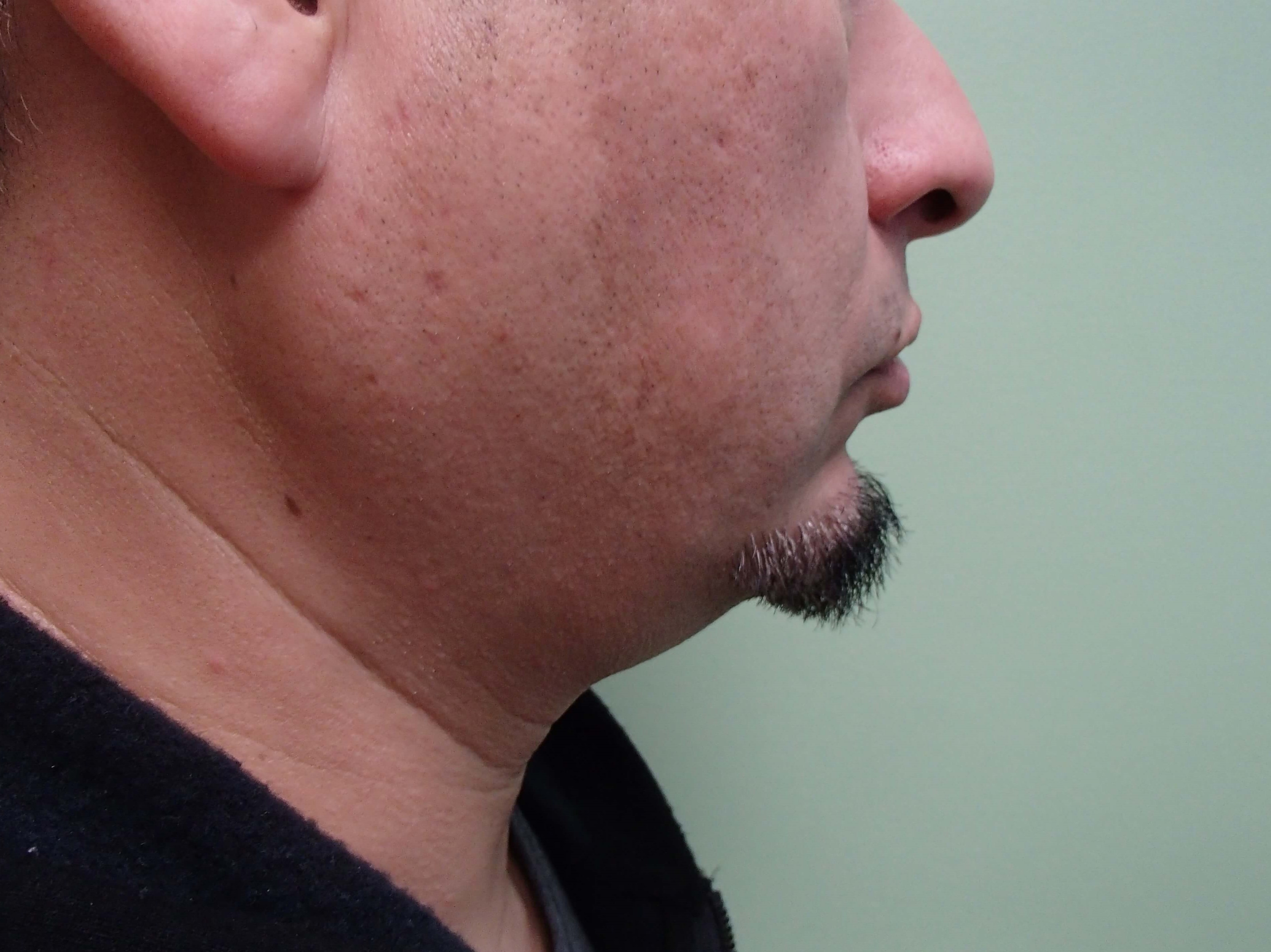 Before Image