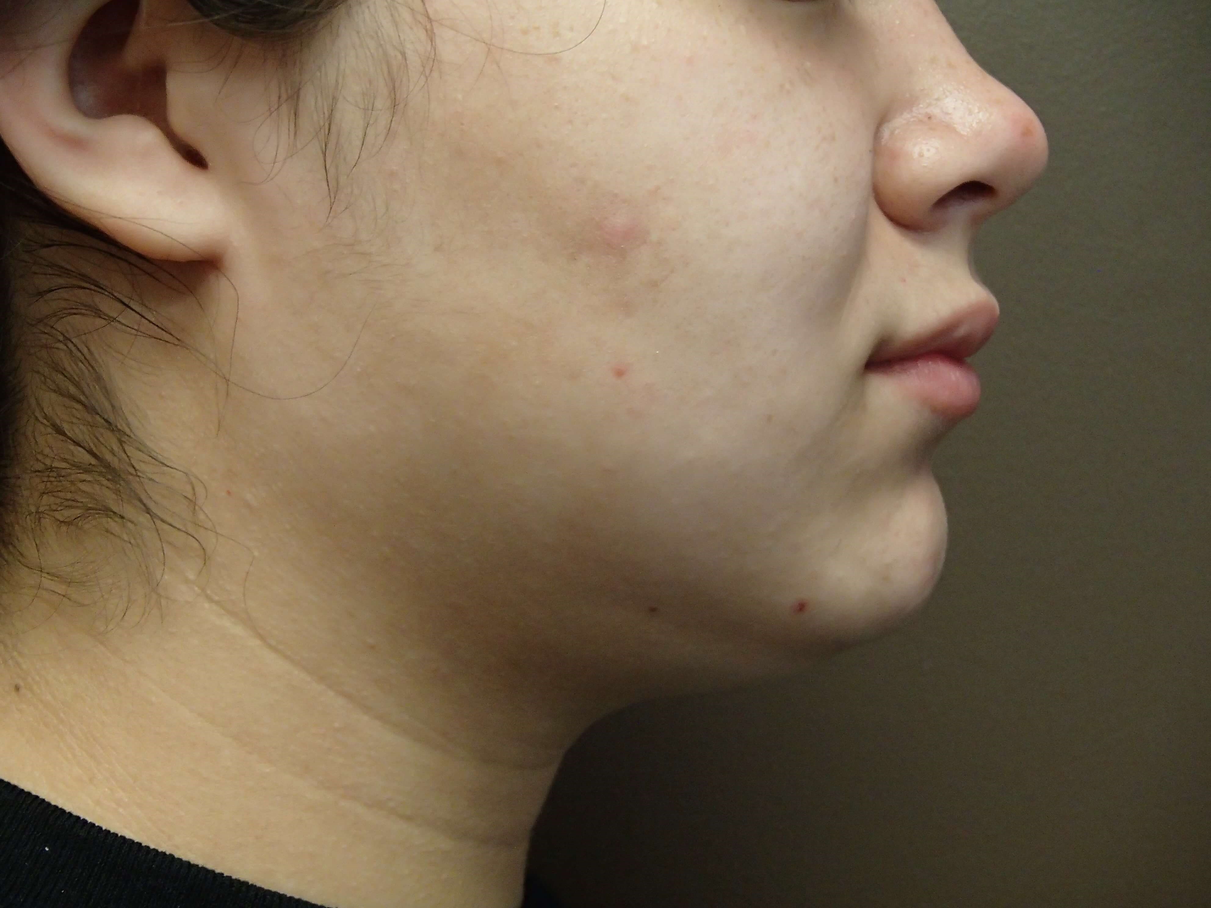 Before Image