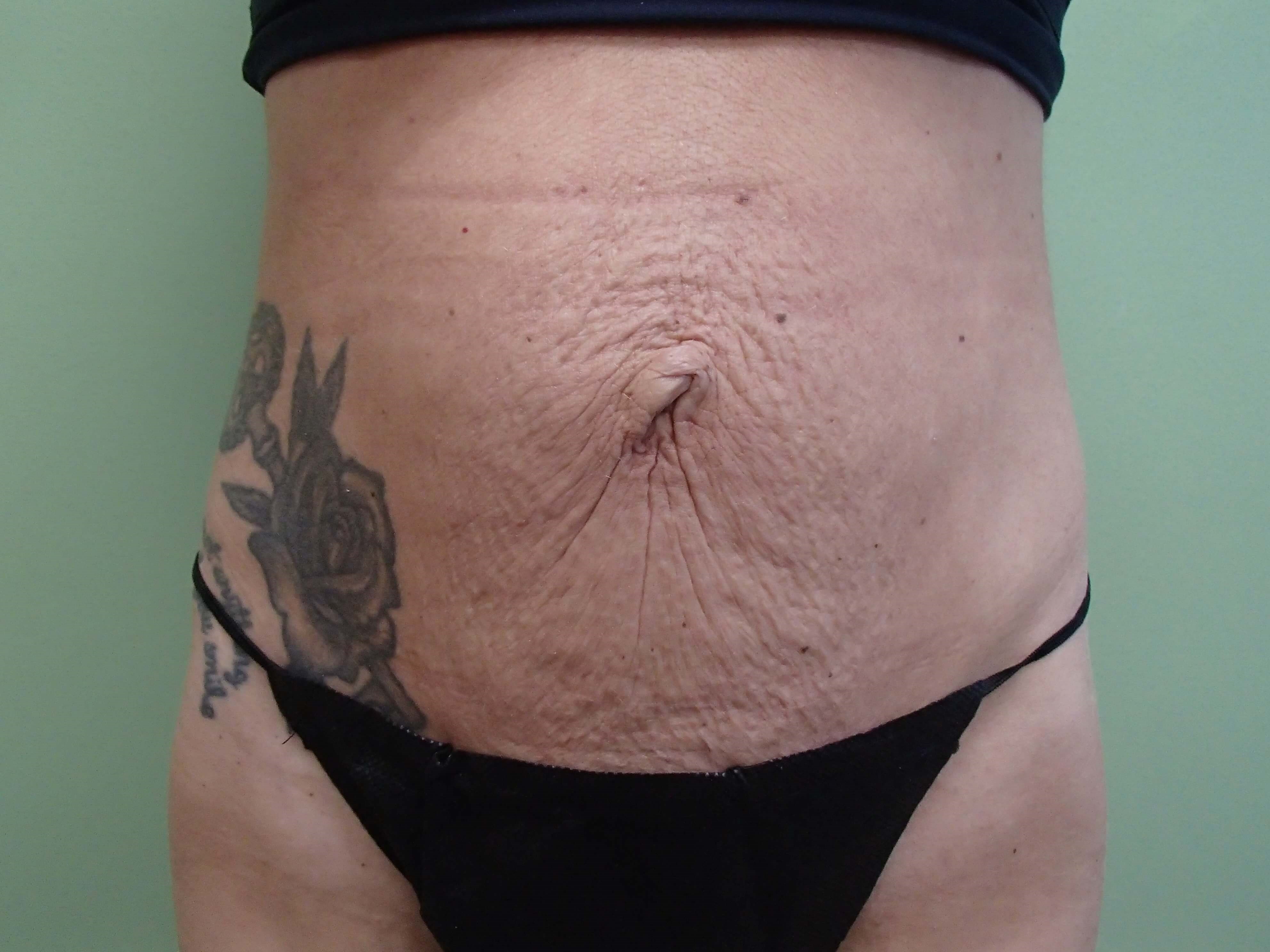 Before Image