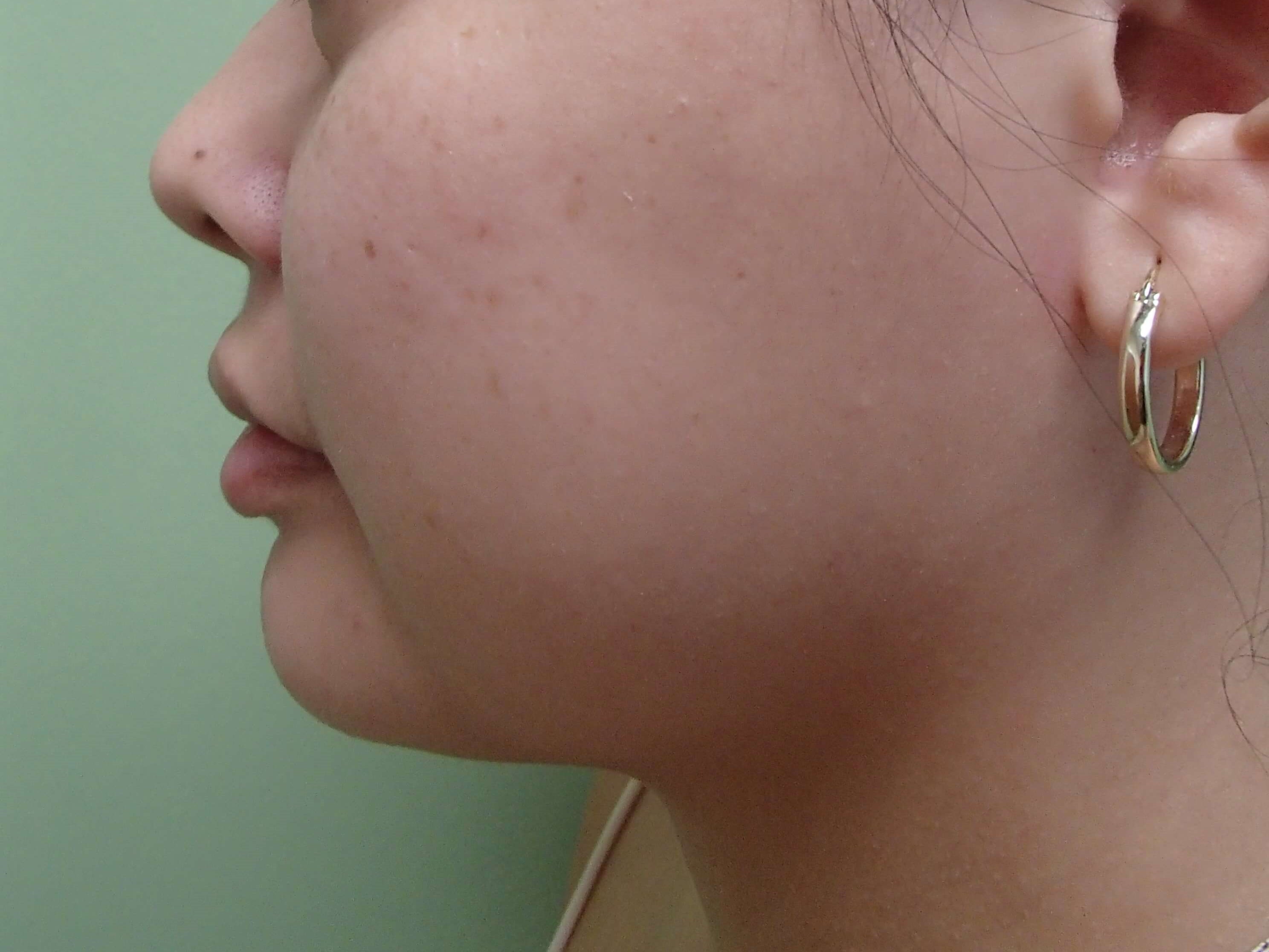 Before Image