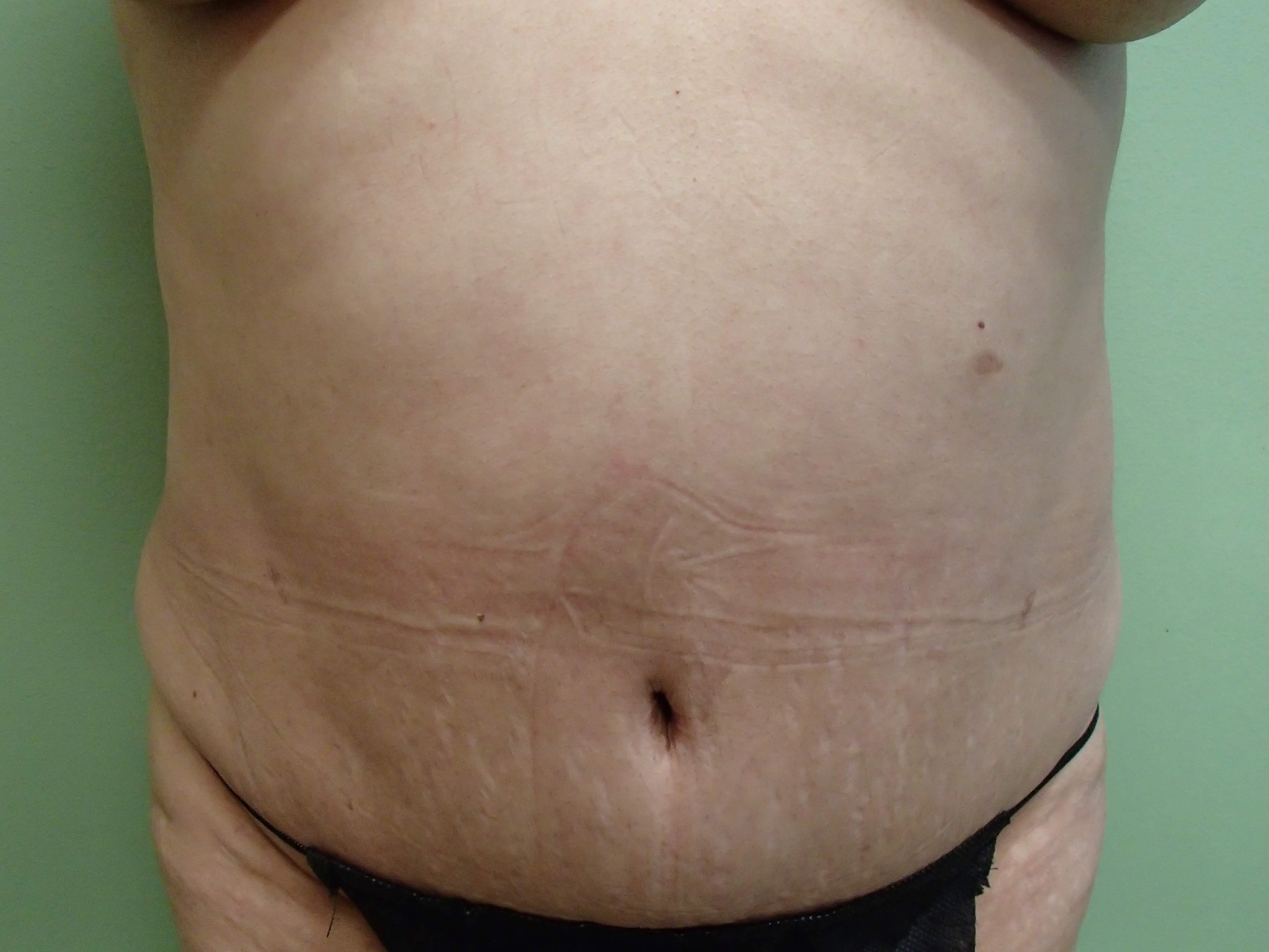 Before Image