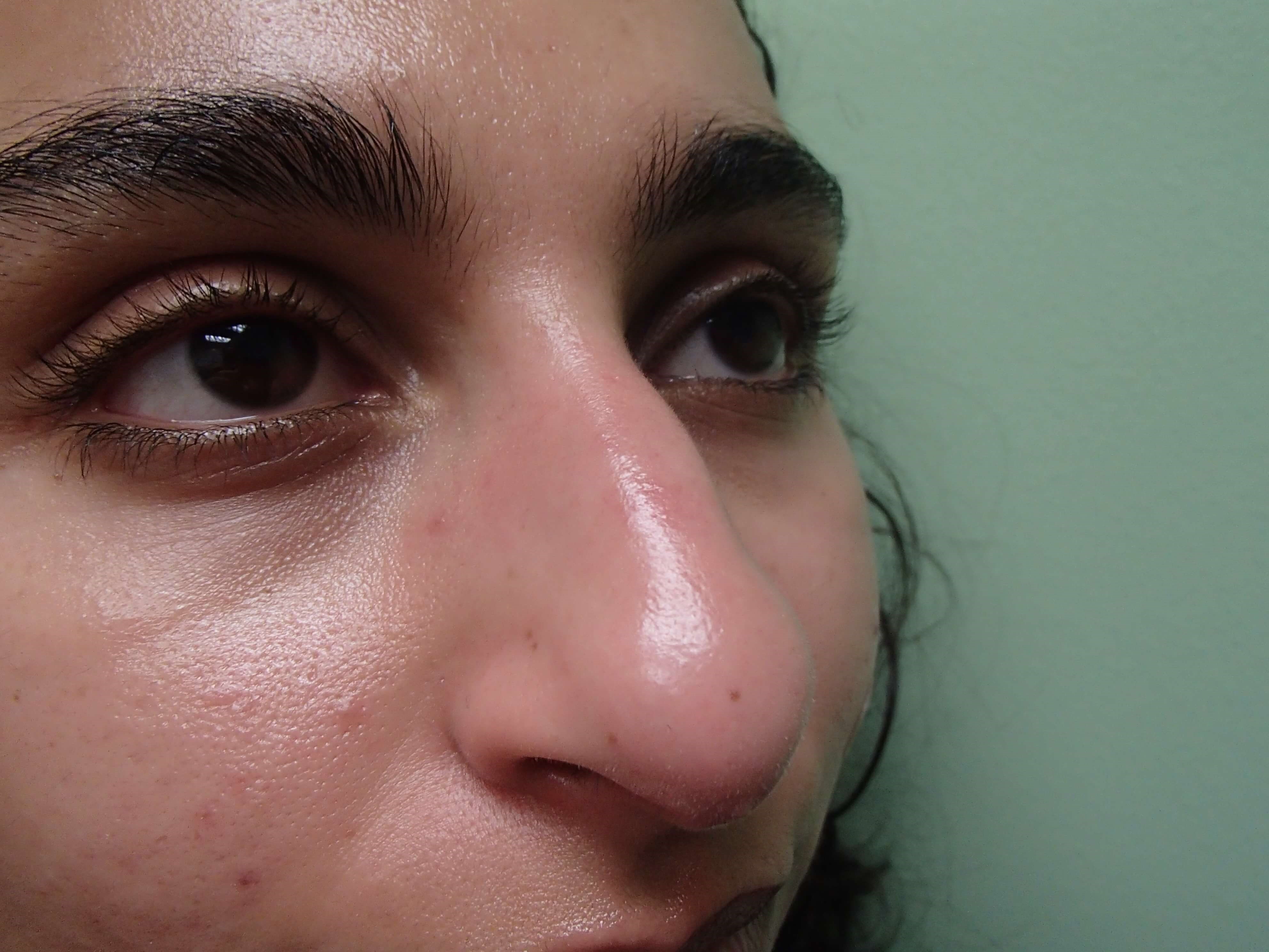 Before Image