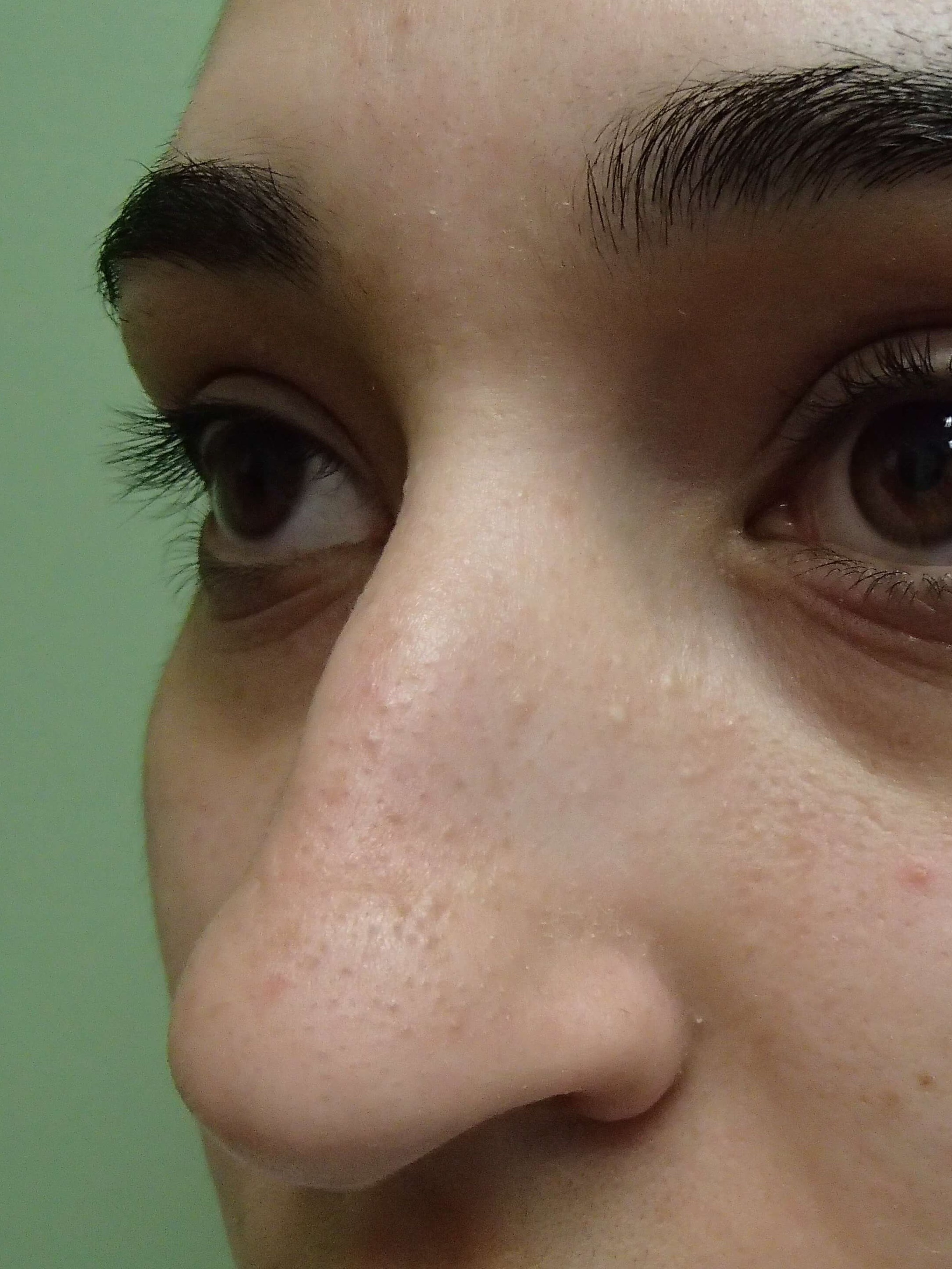 Before Image