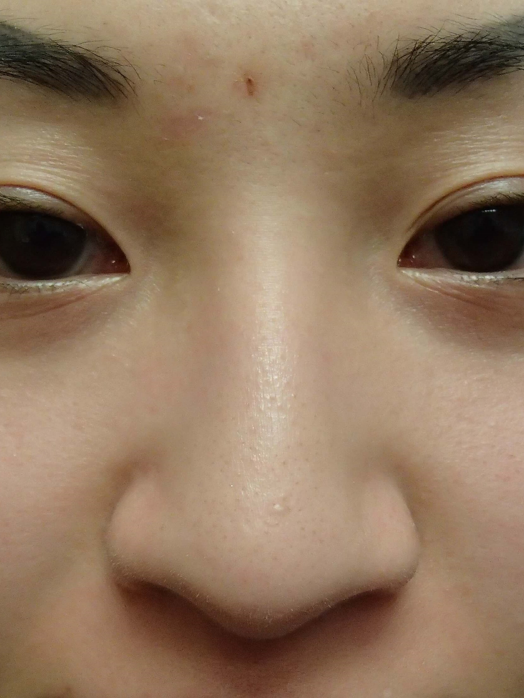 Before Image