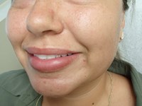 Before Image