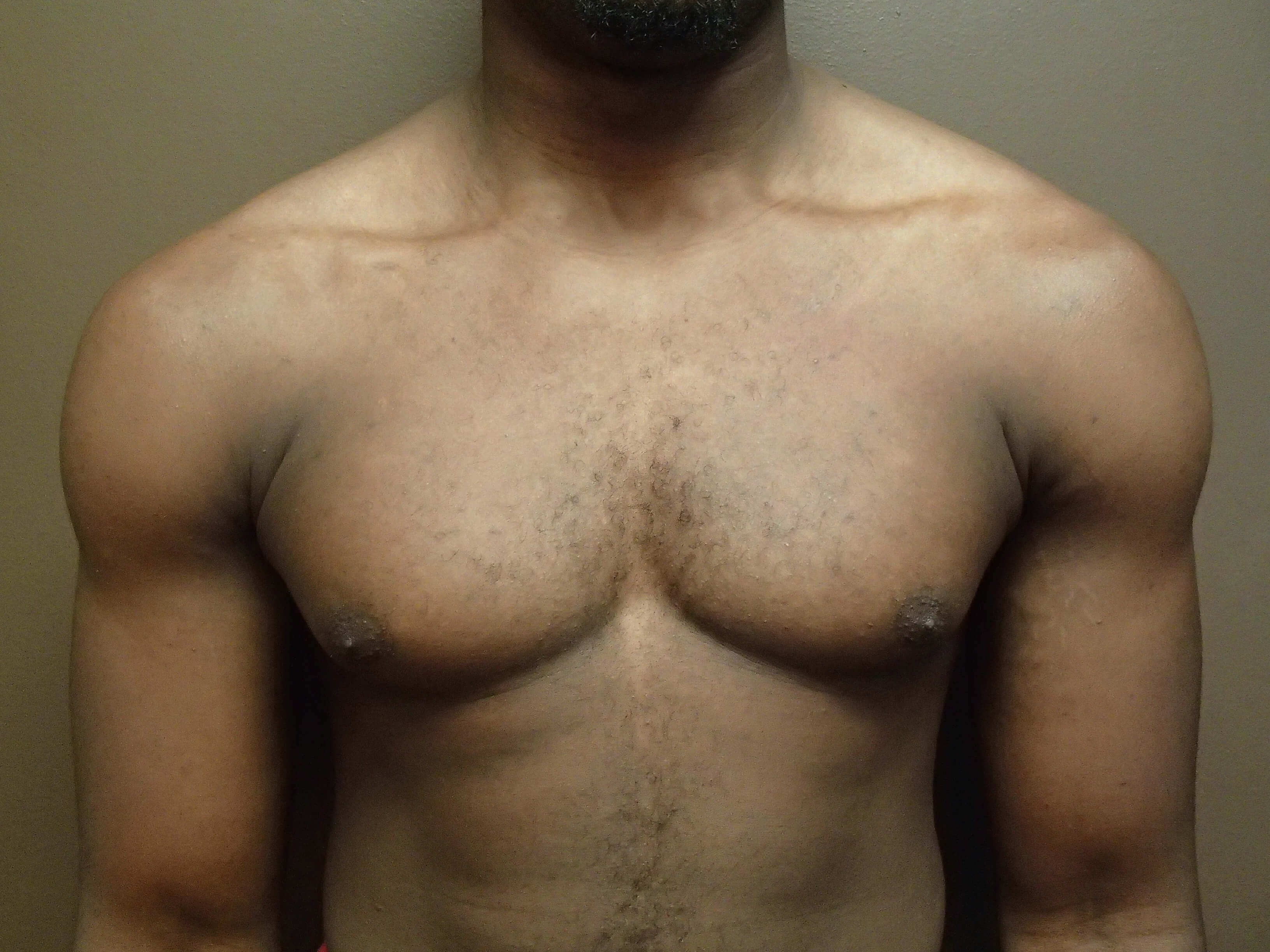 Before Image