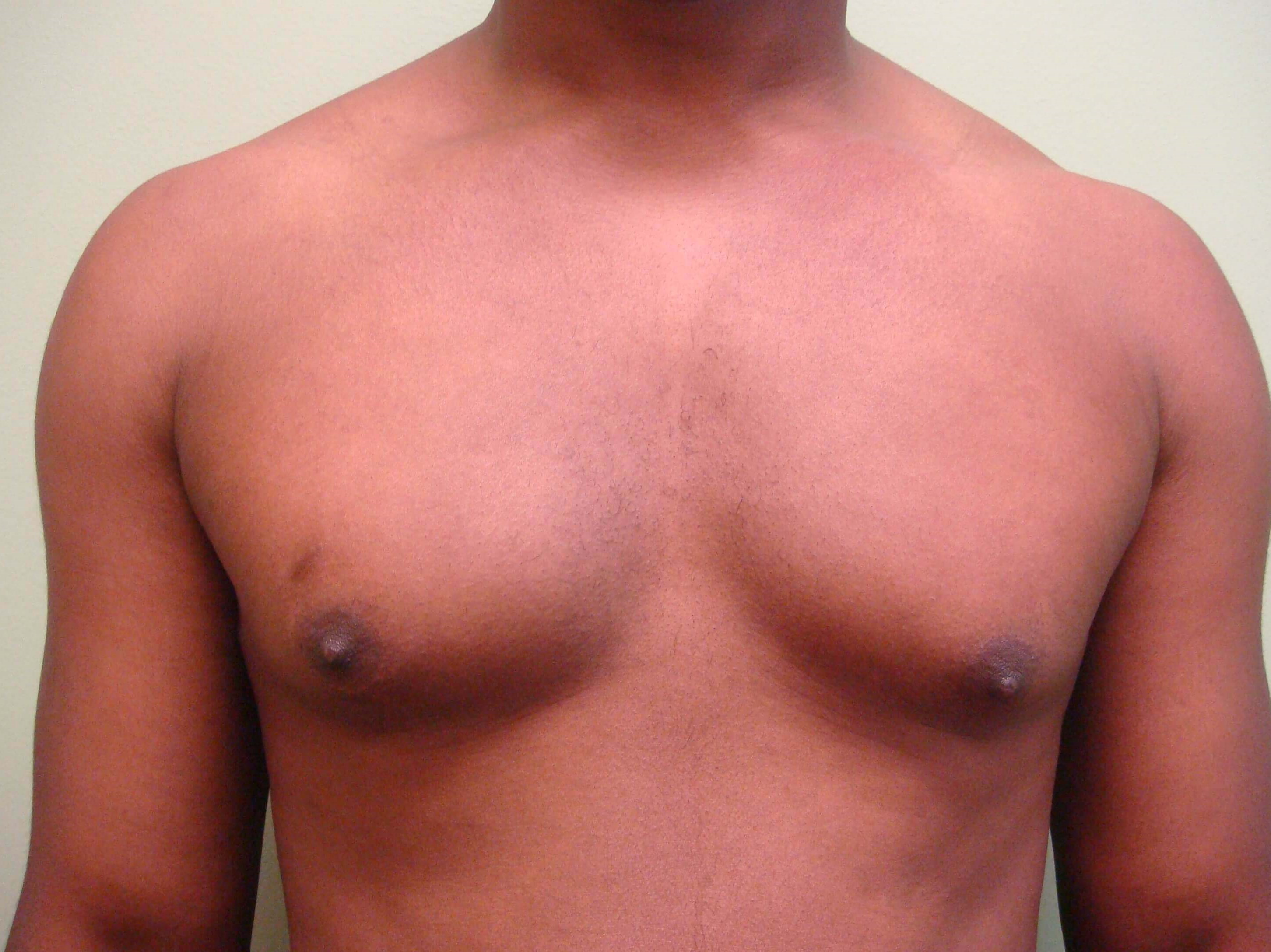 Before Image
