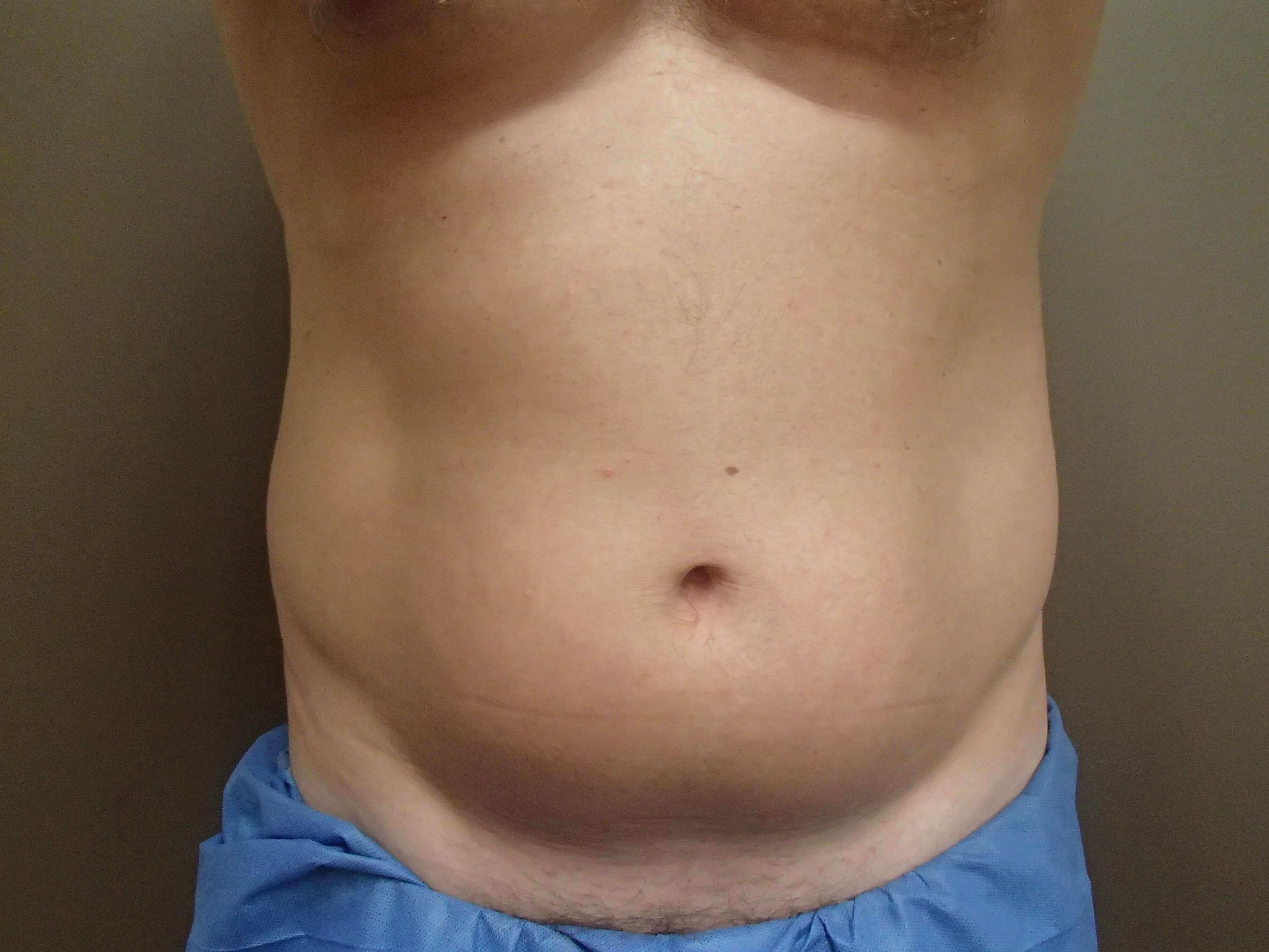Before Image