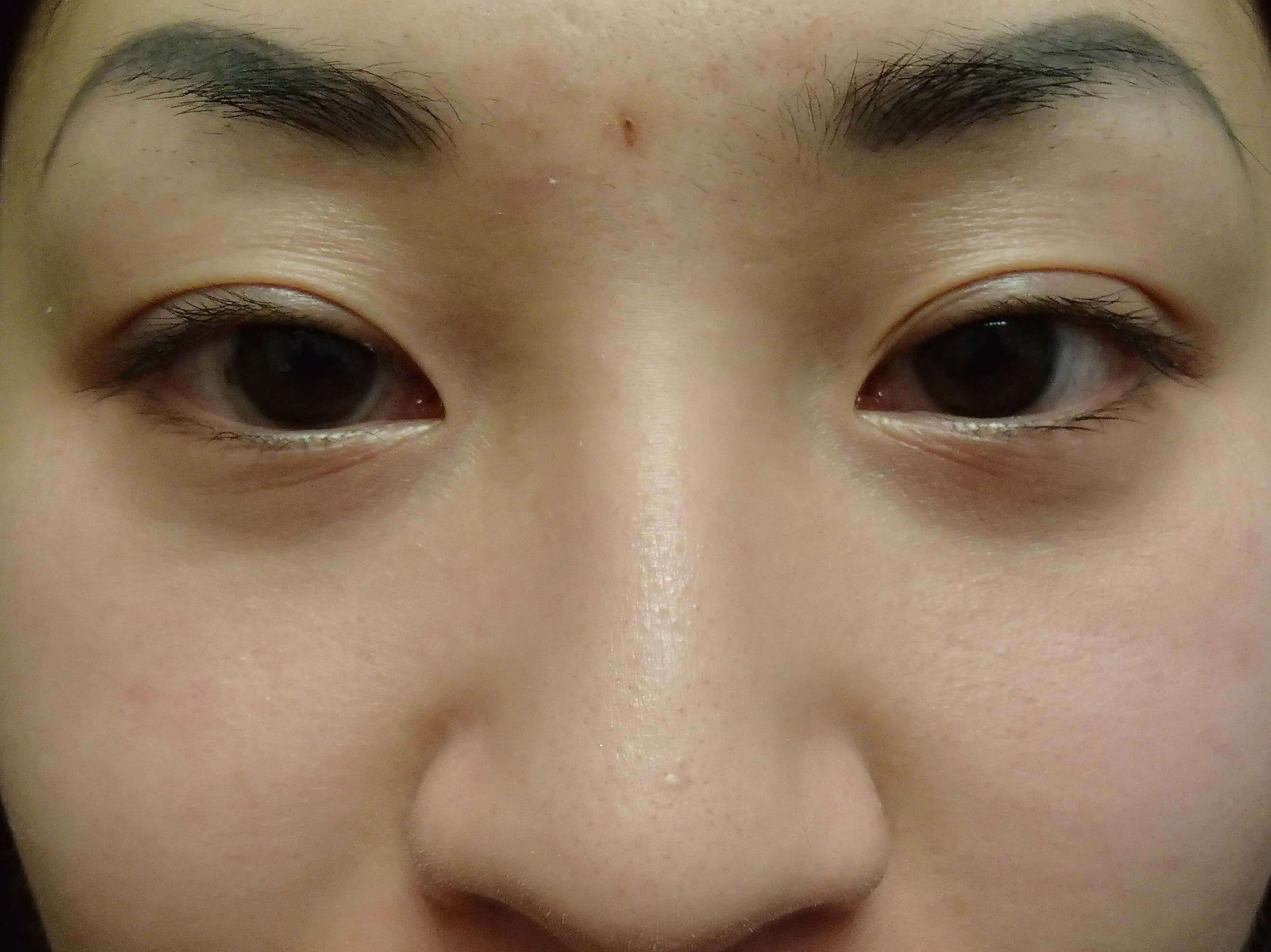 Before Image
