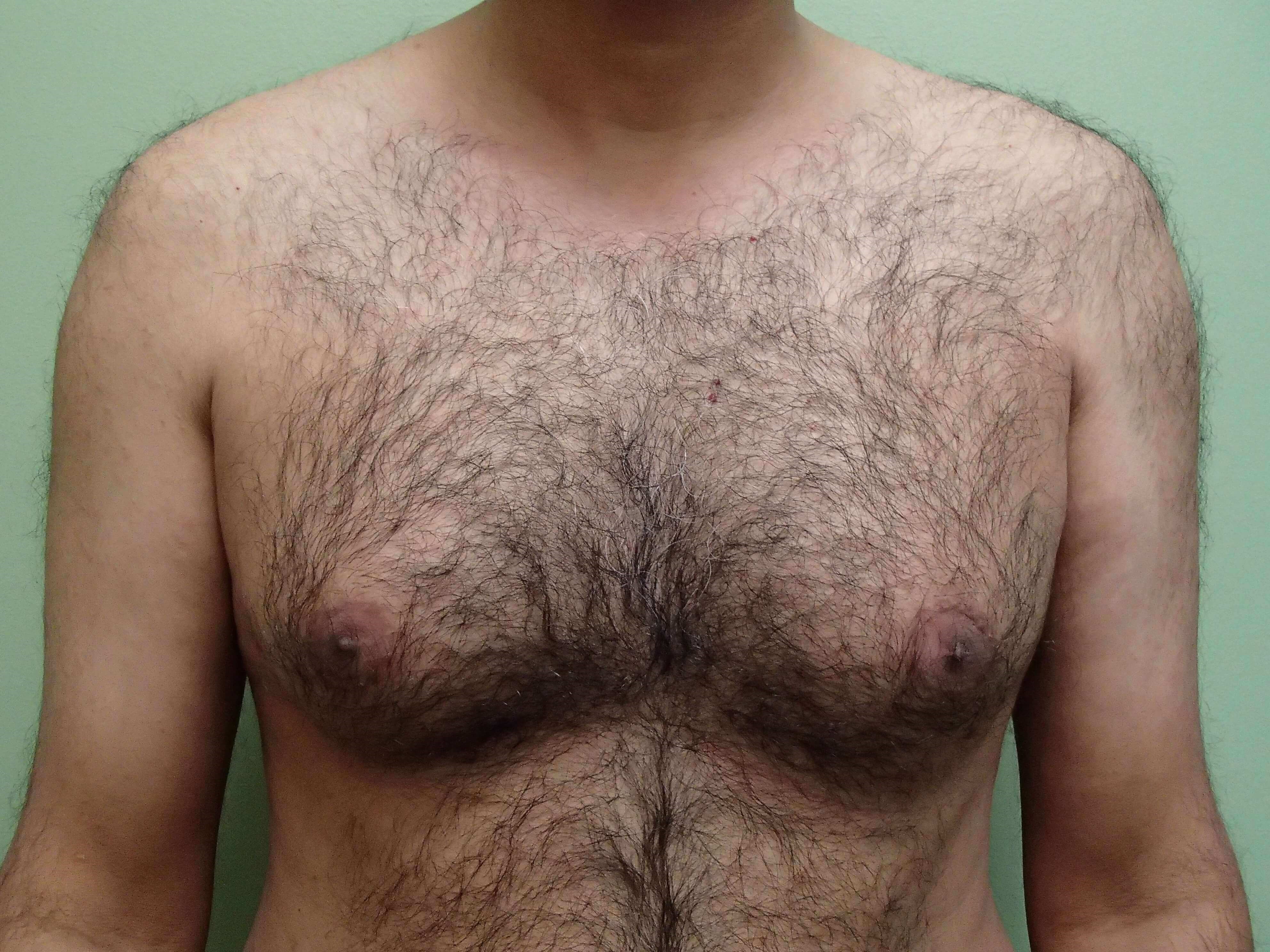 Before Image