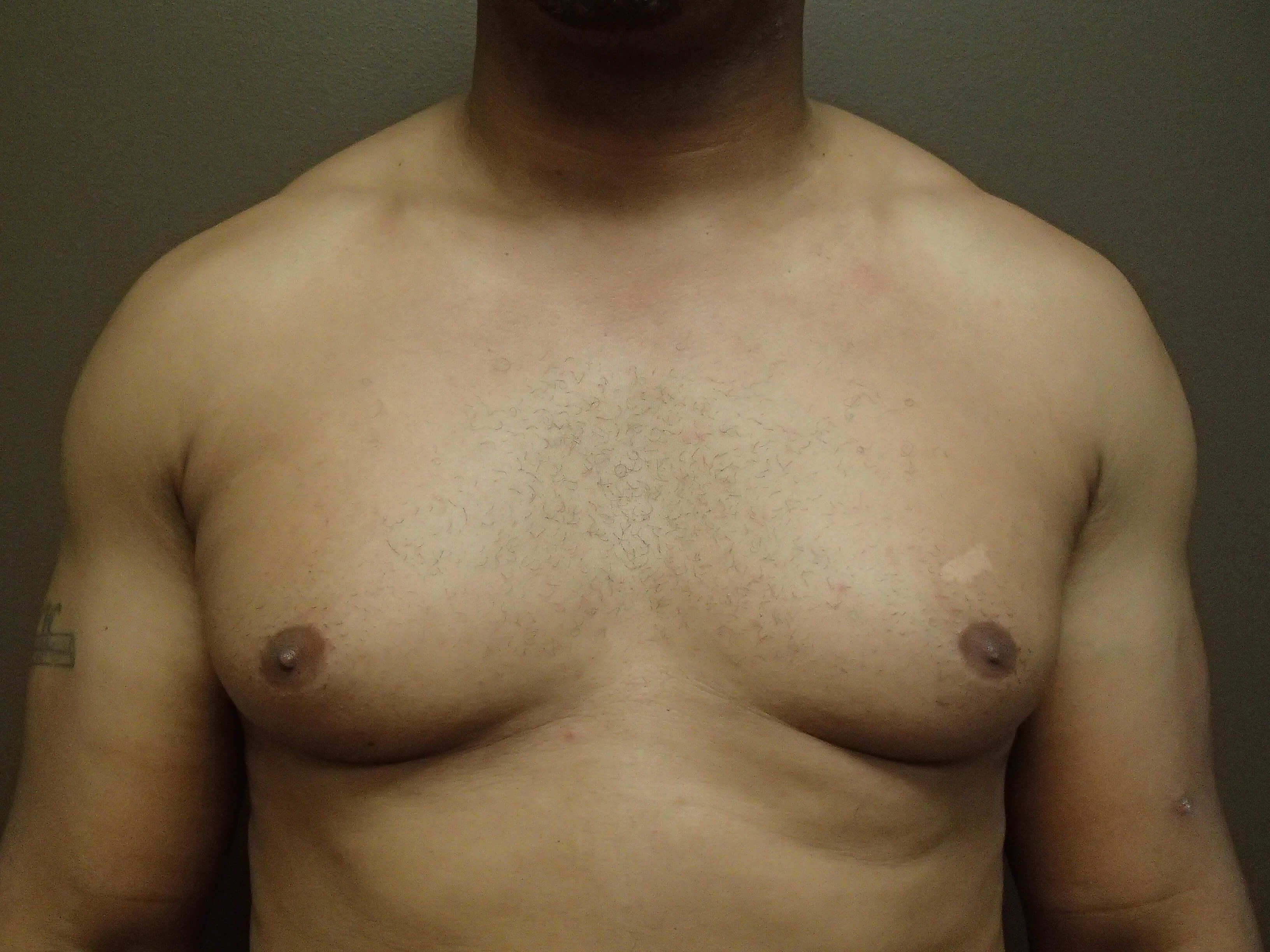 Before Image