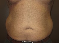 Before Image