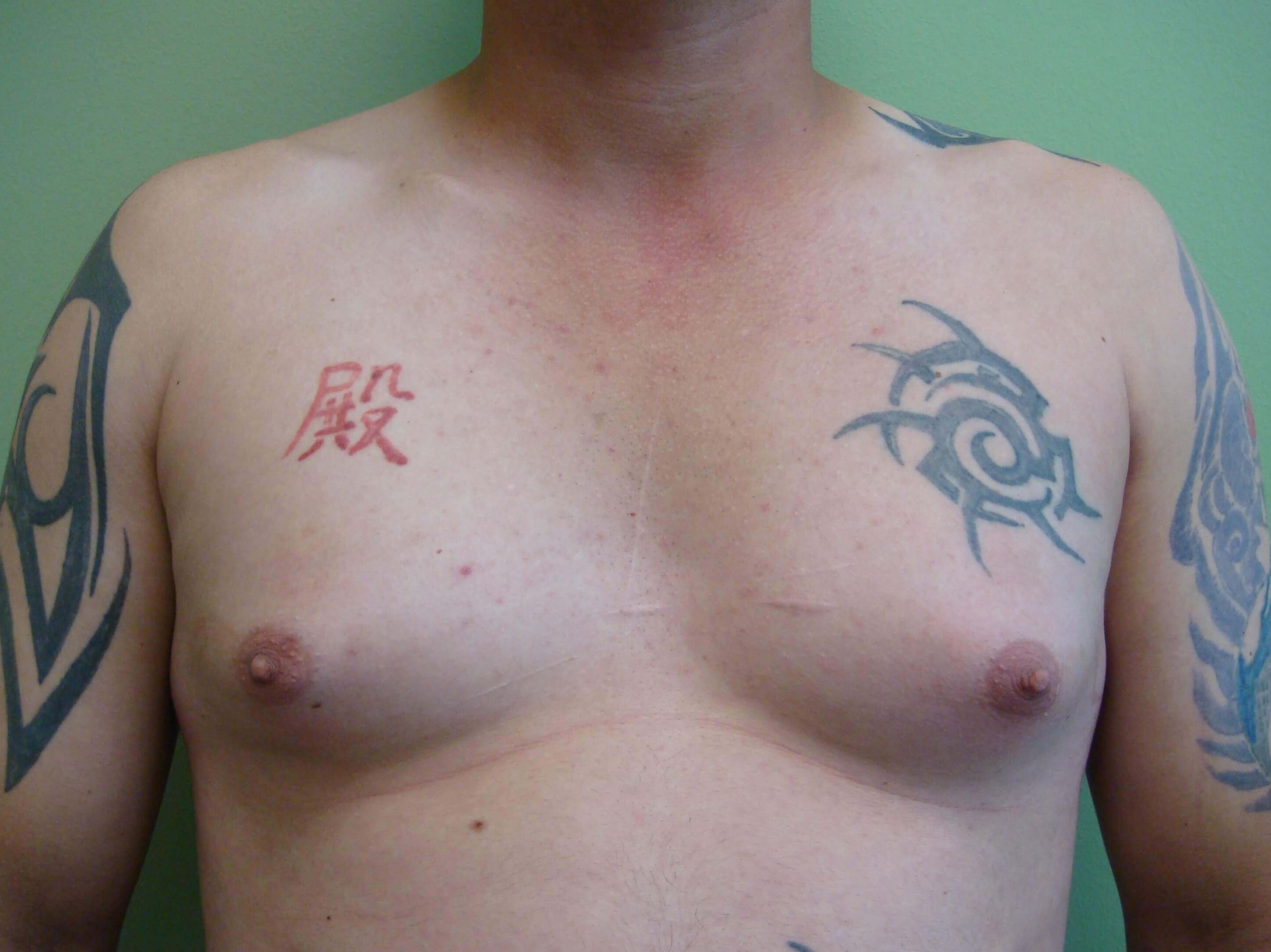 Before Image