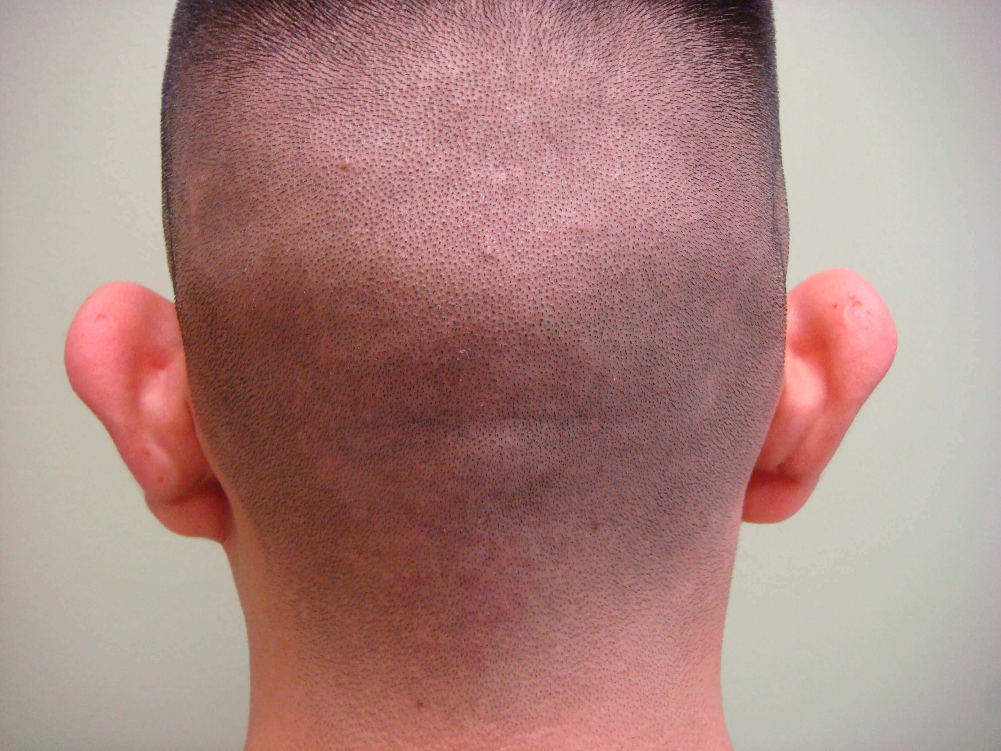 Before Image