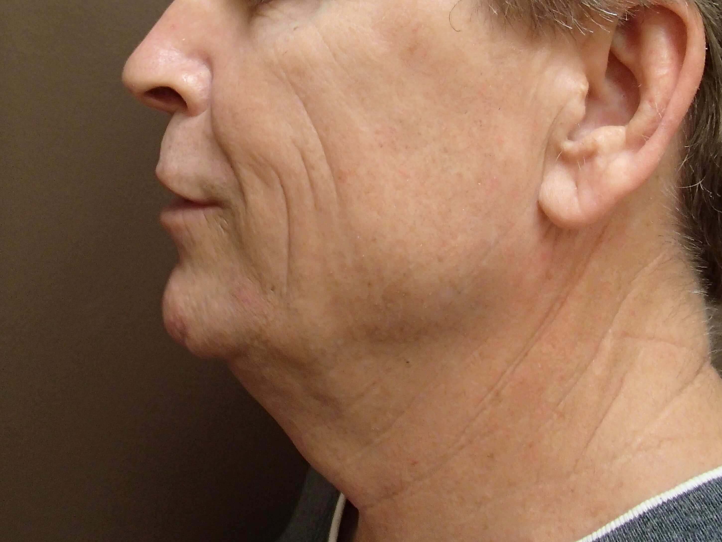 Before Image