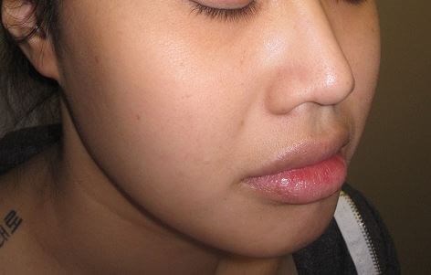 Before Image