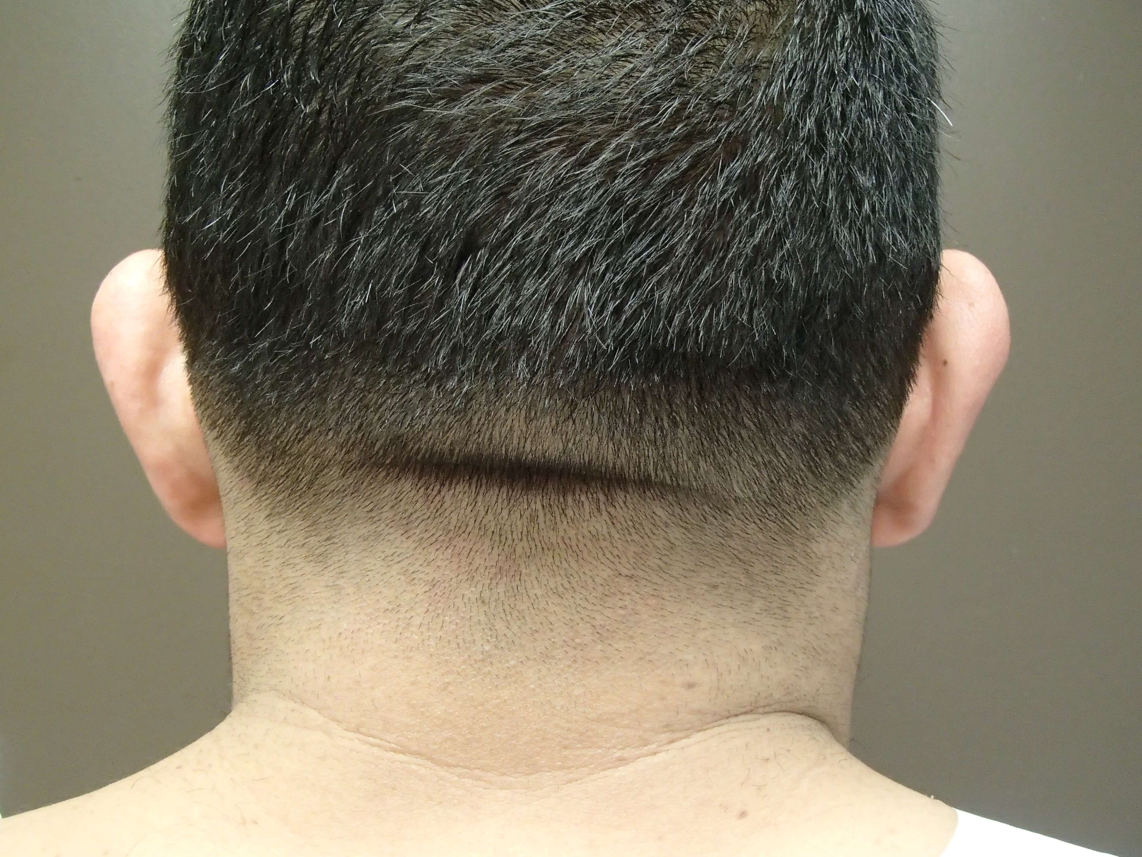 Before Image