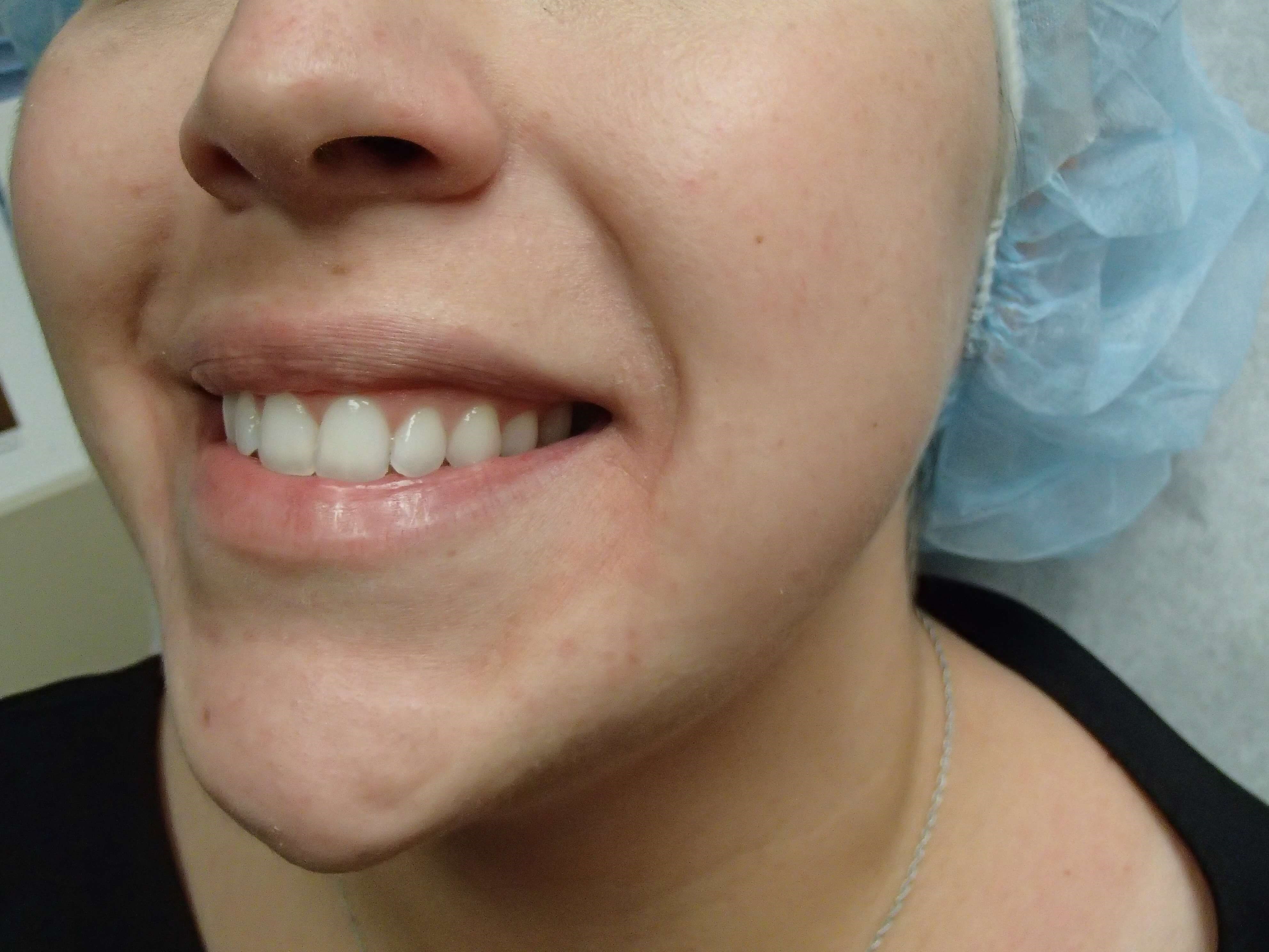 Before Image