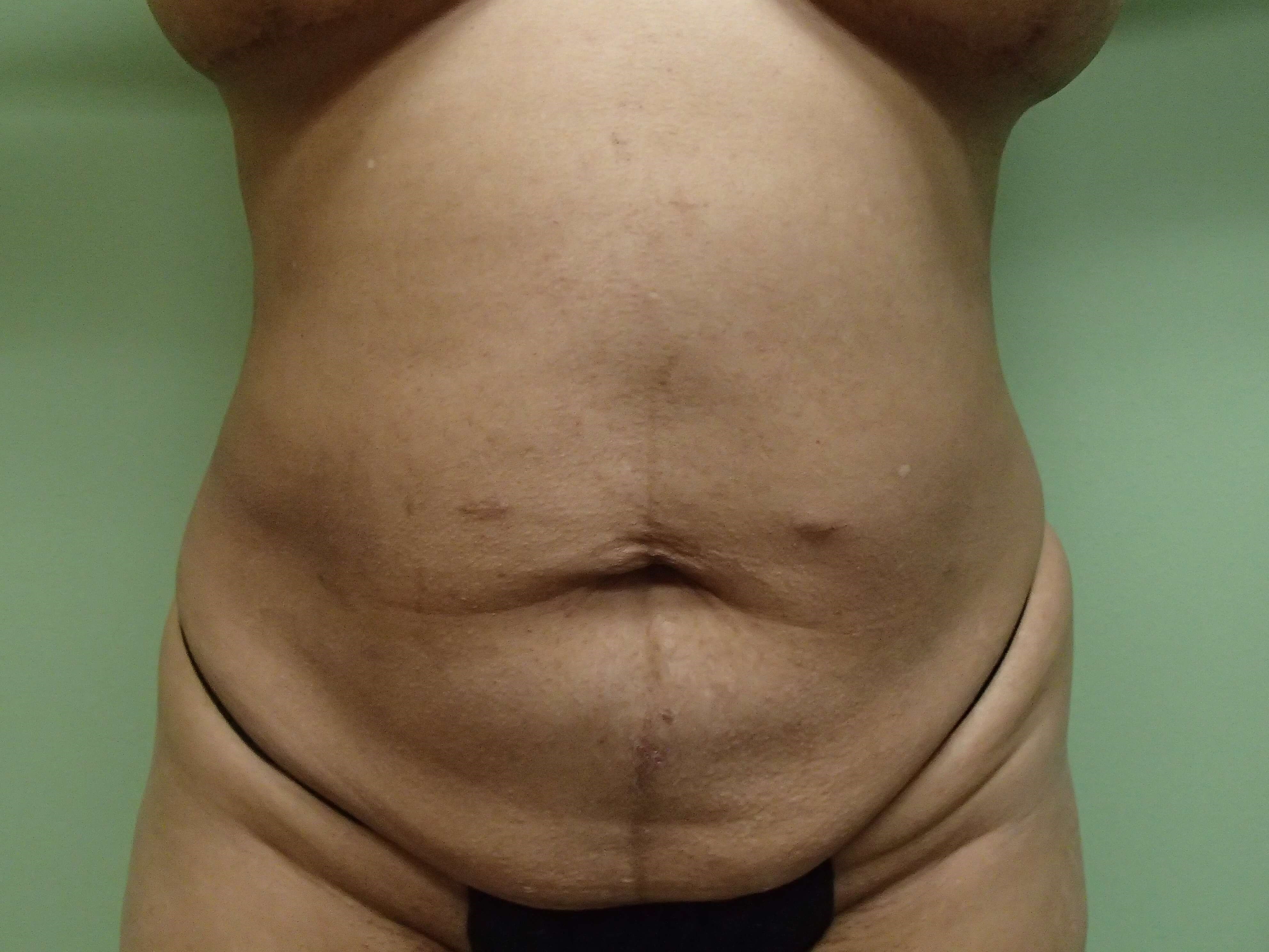 Before Image