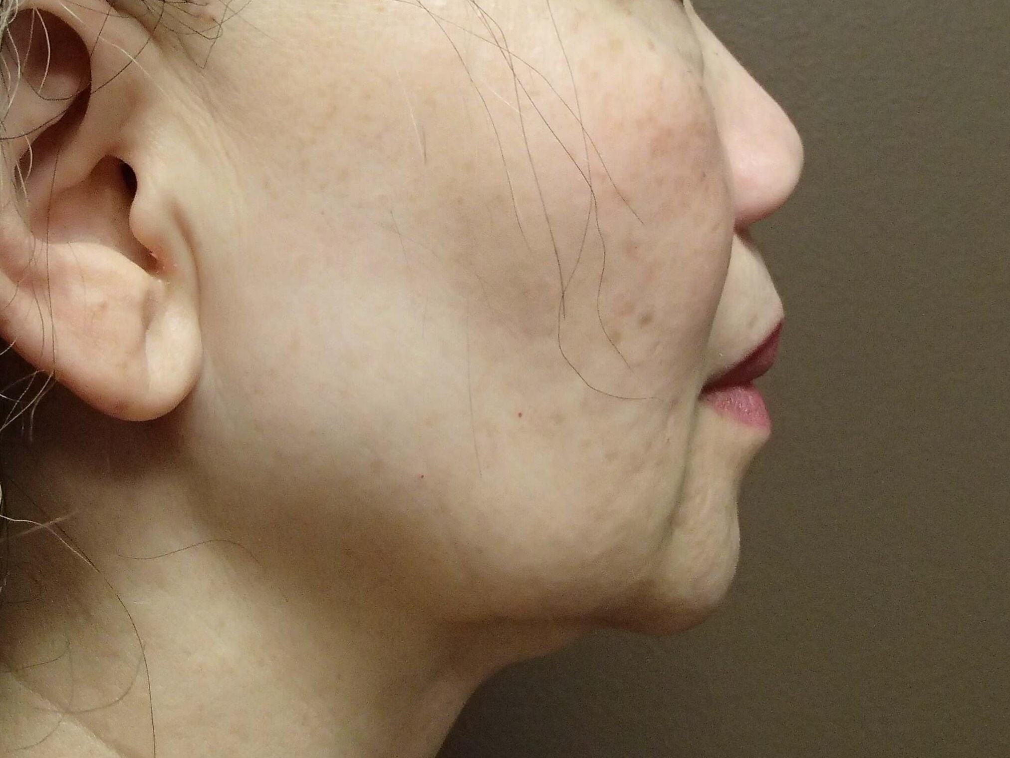 Before Image