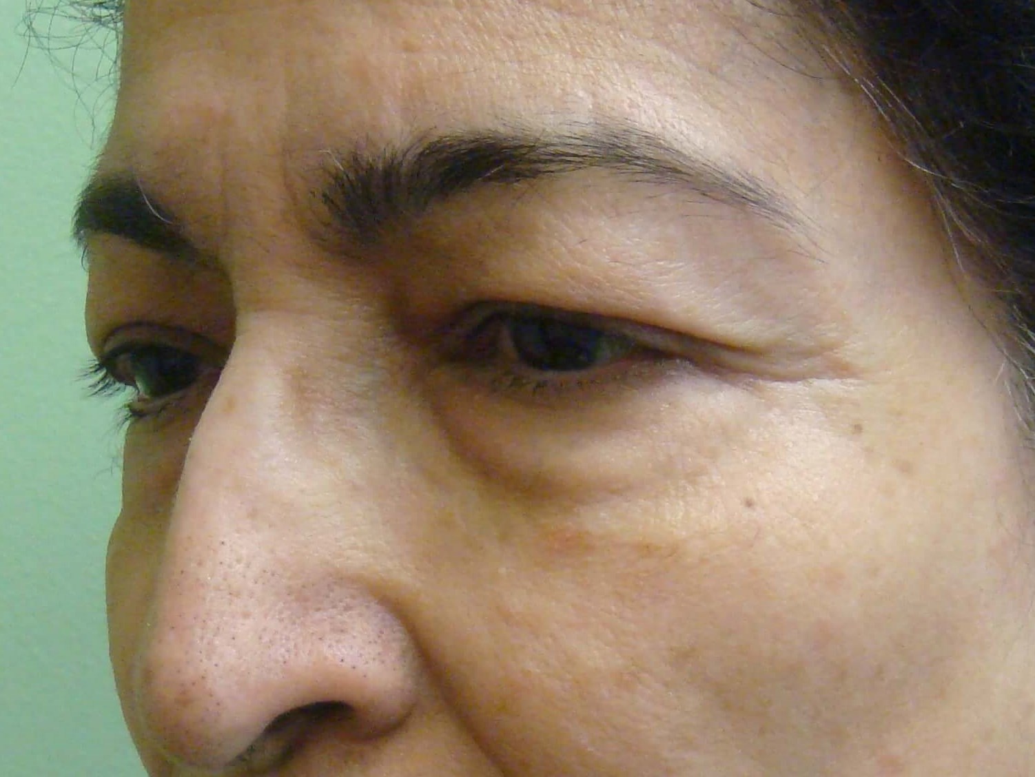 Before Image