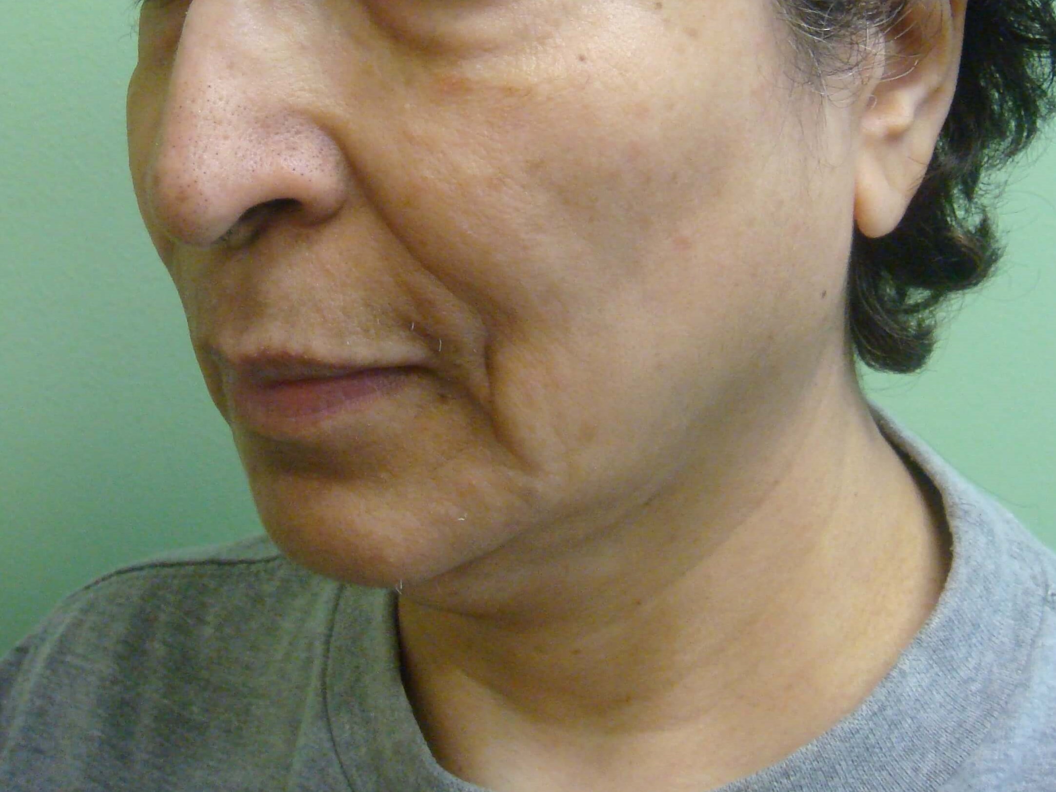 Before Image