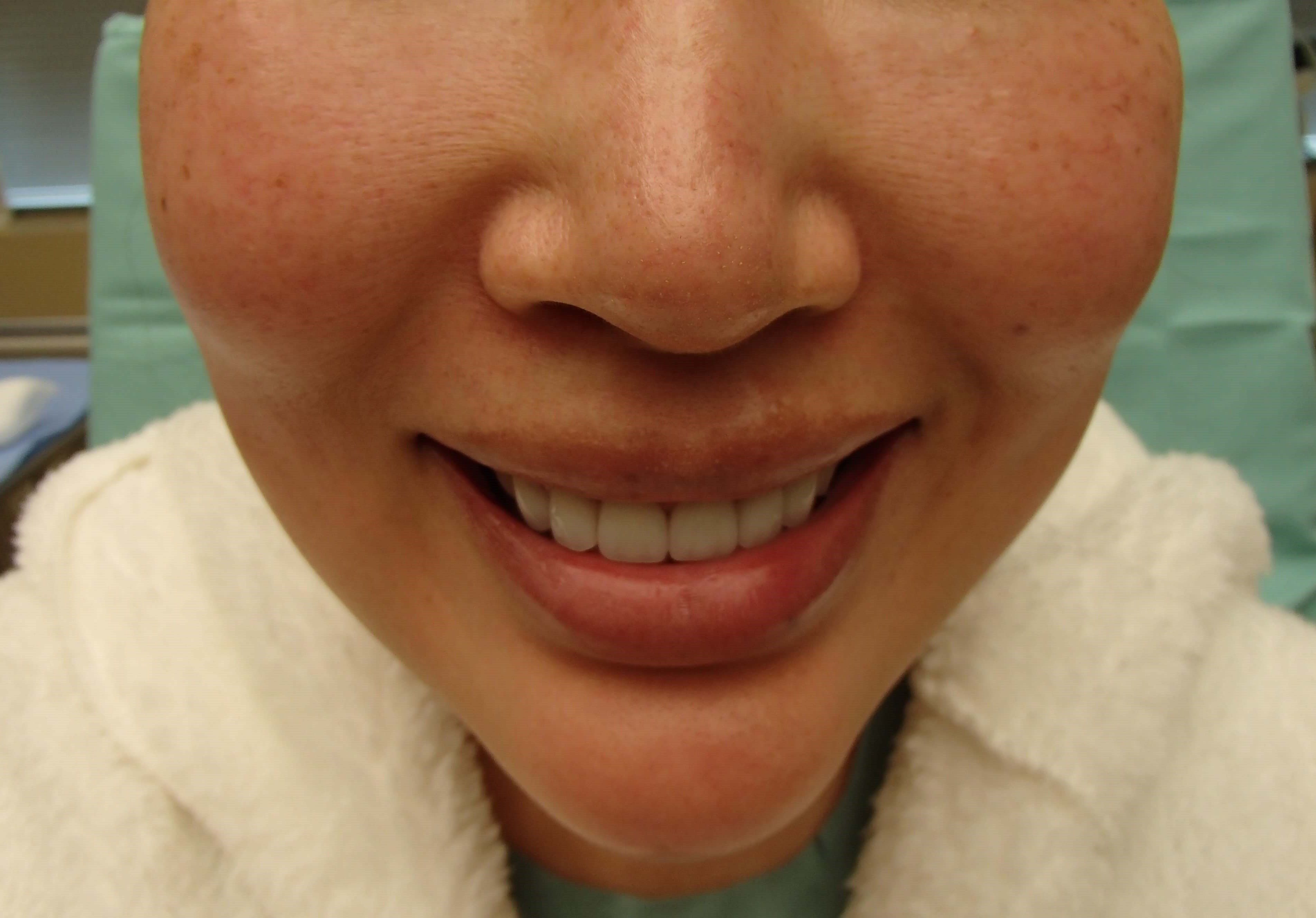 Before Image
