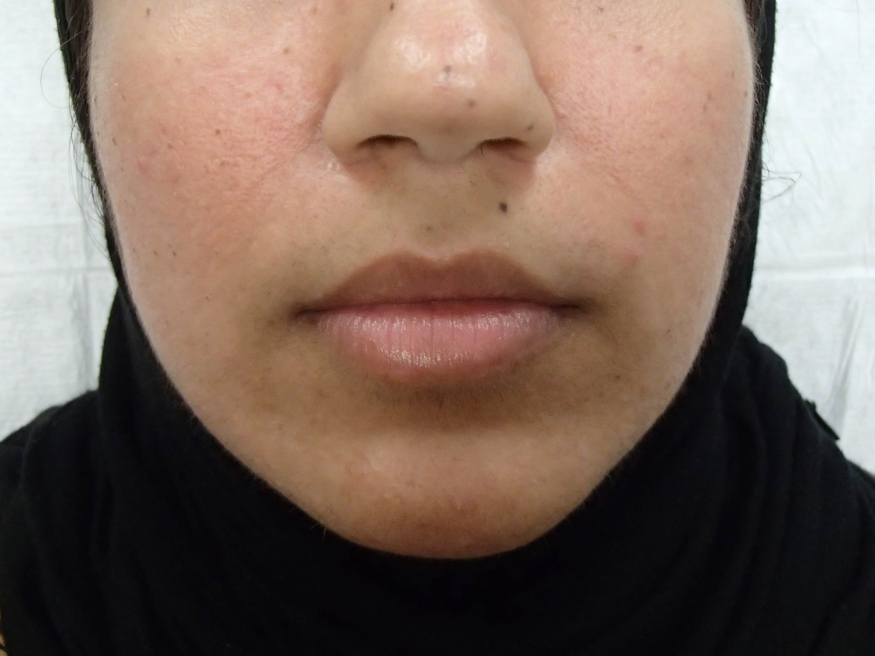 Before Image