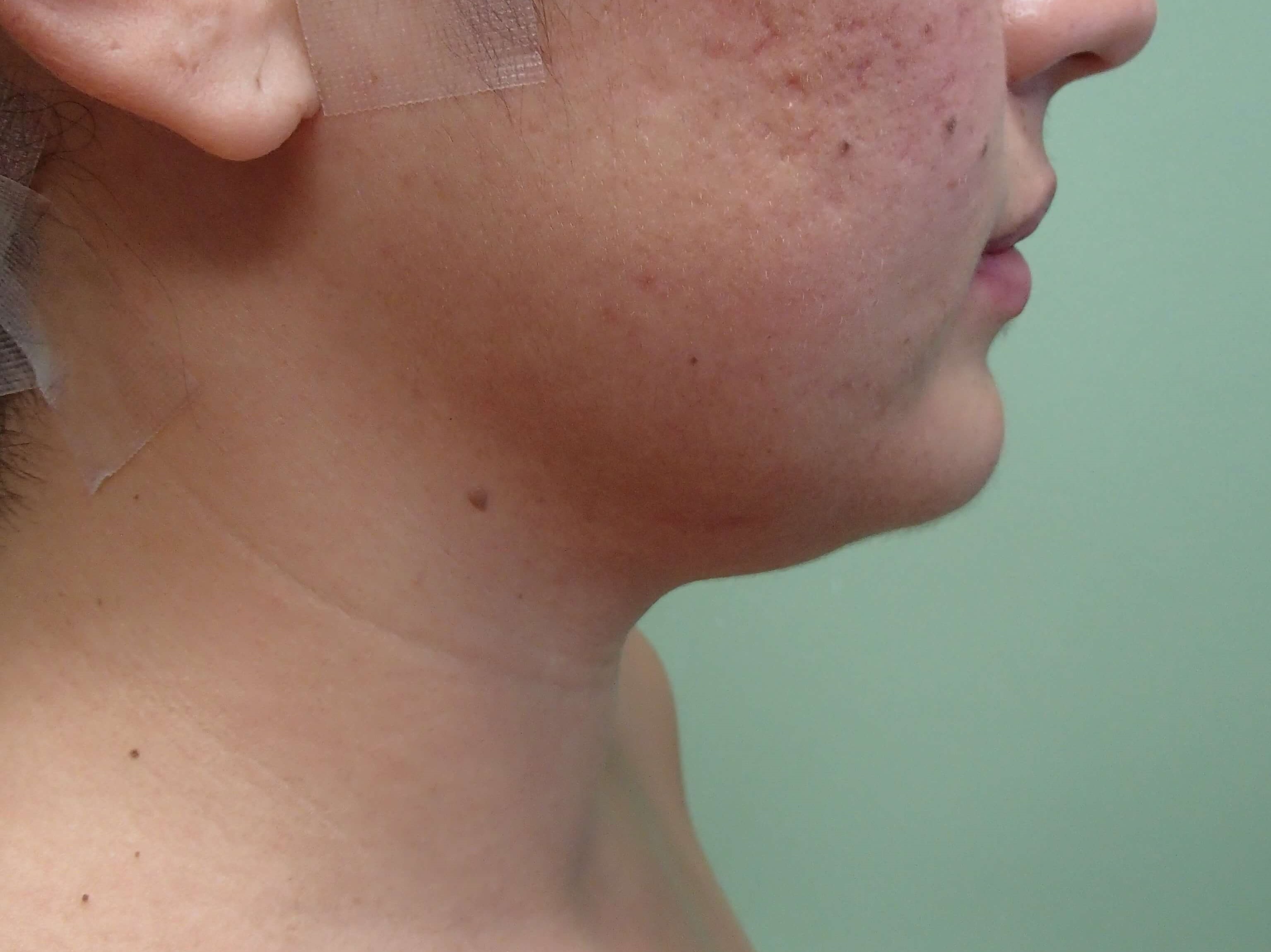 Before Image