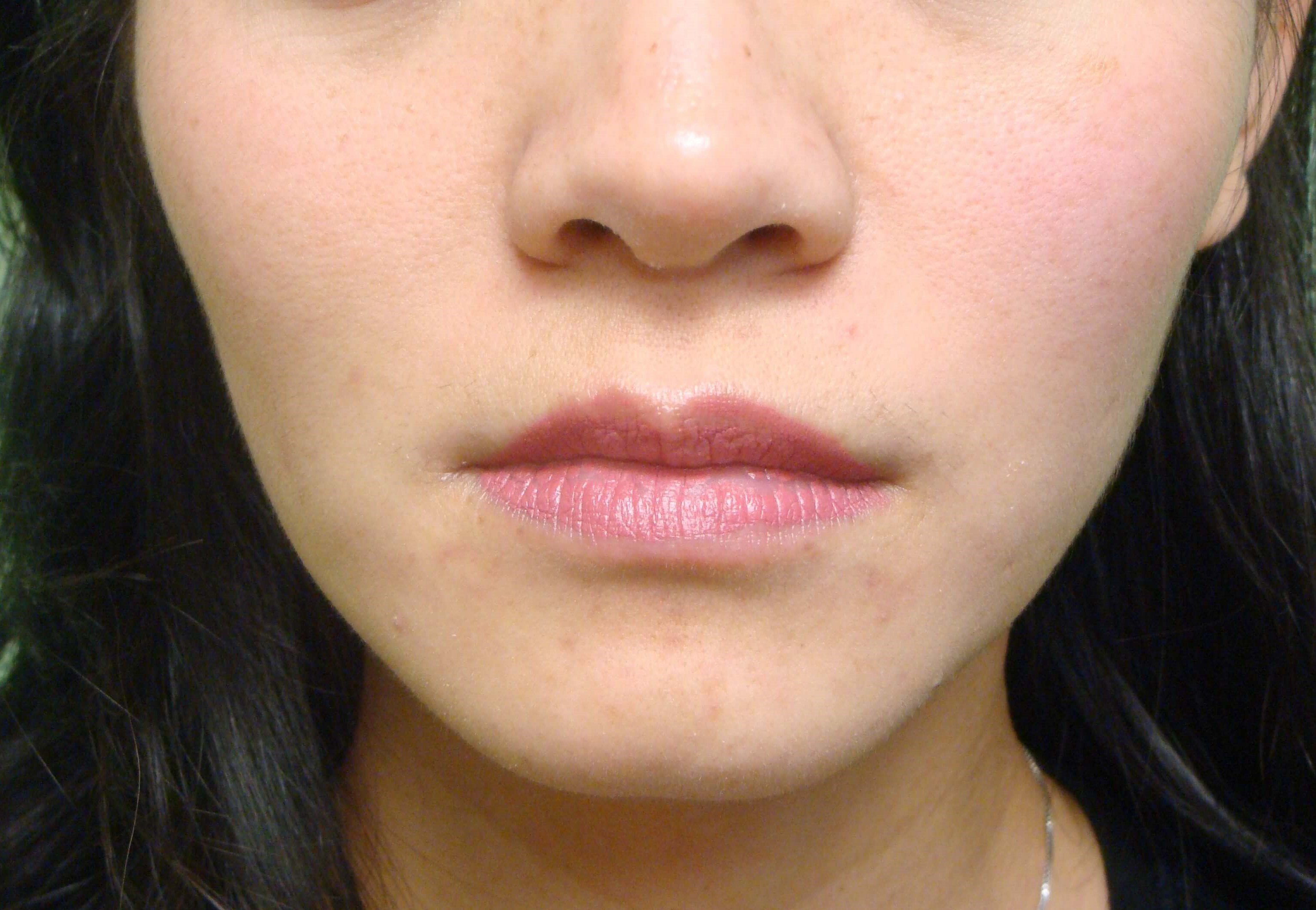 Before Image