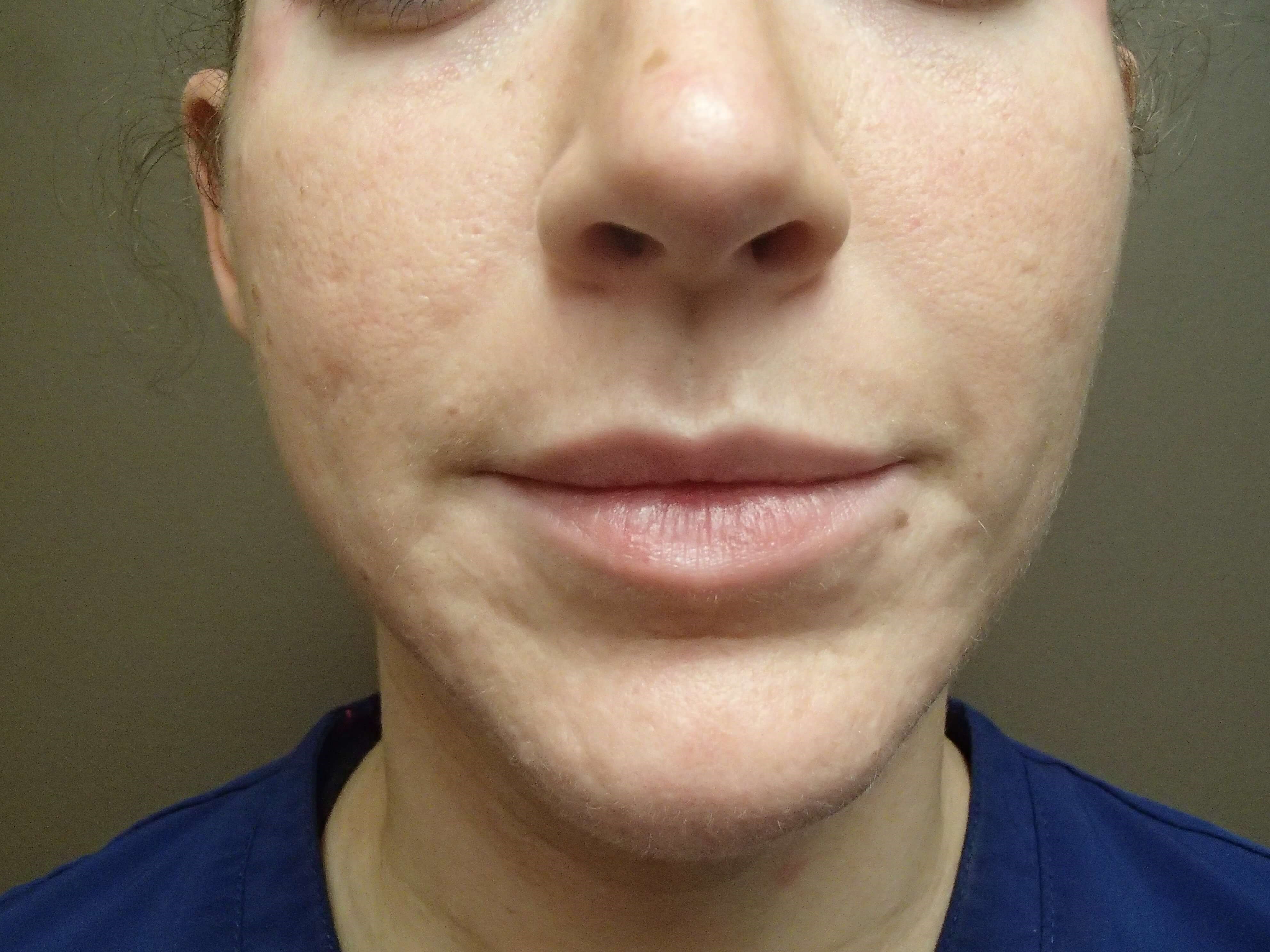 Before Image
