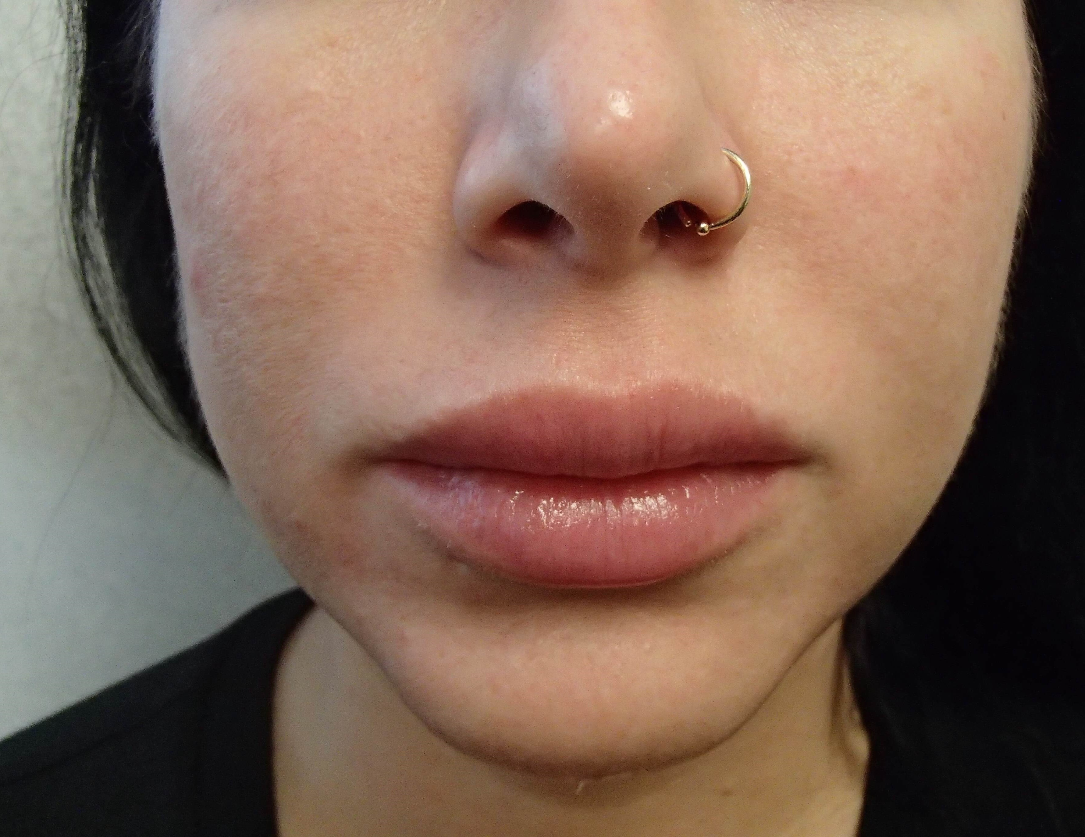 Before Image