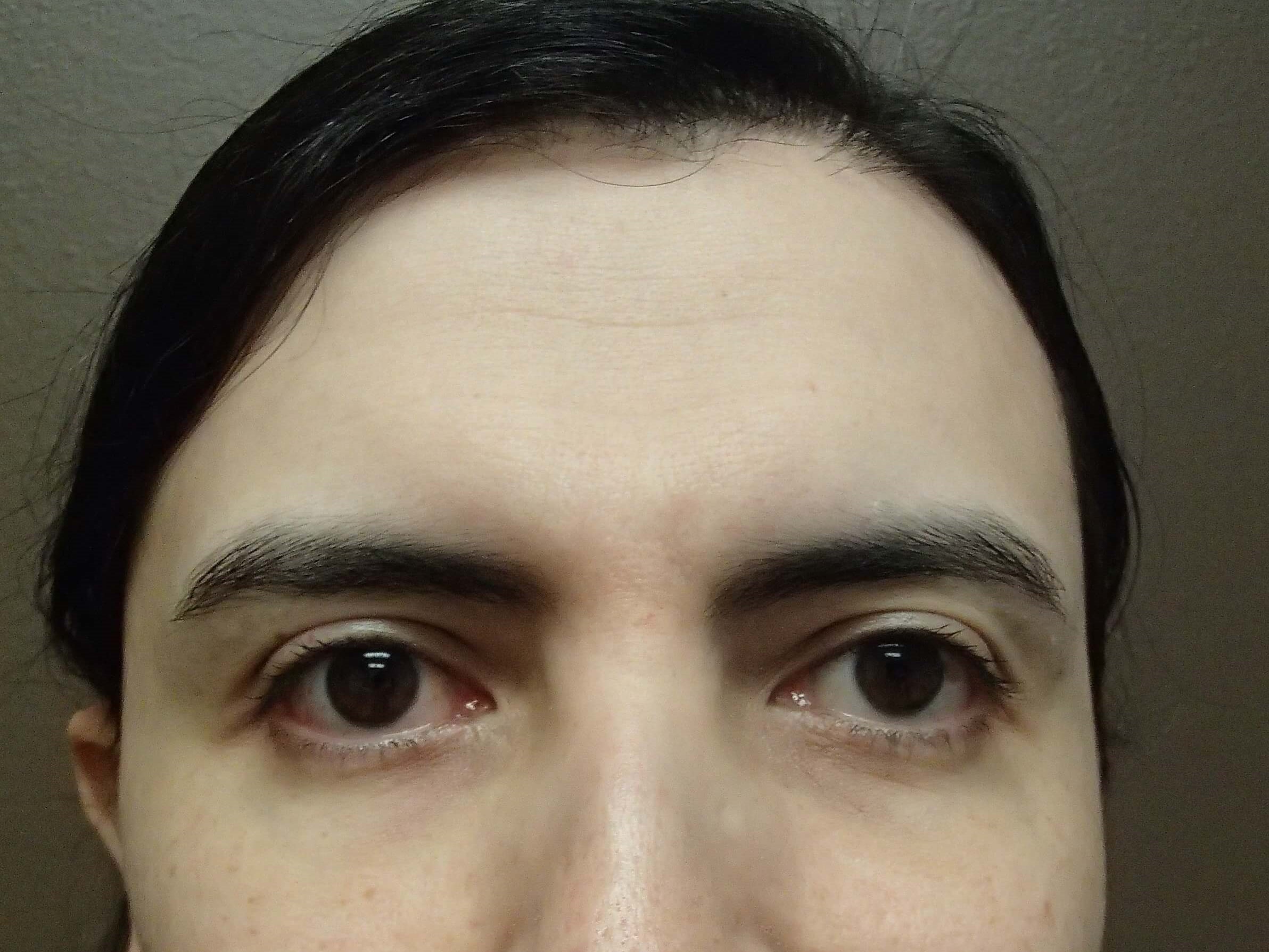 Before Image
