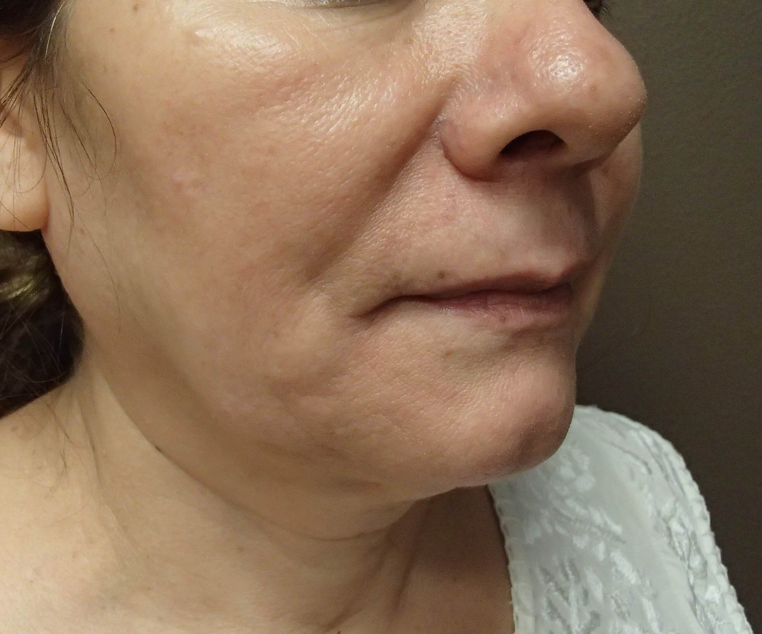 Before Image