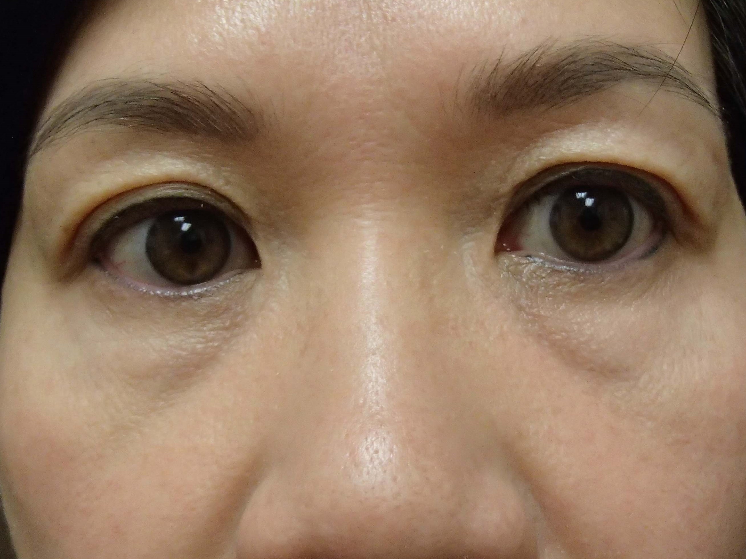 Before Image