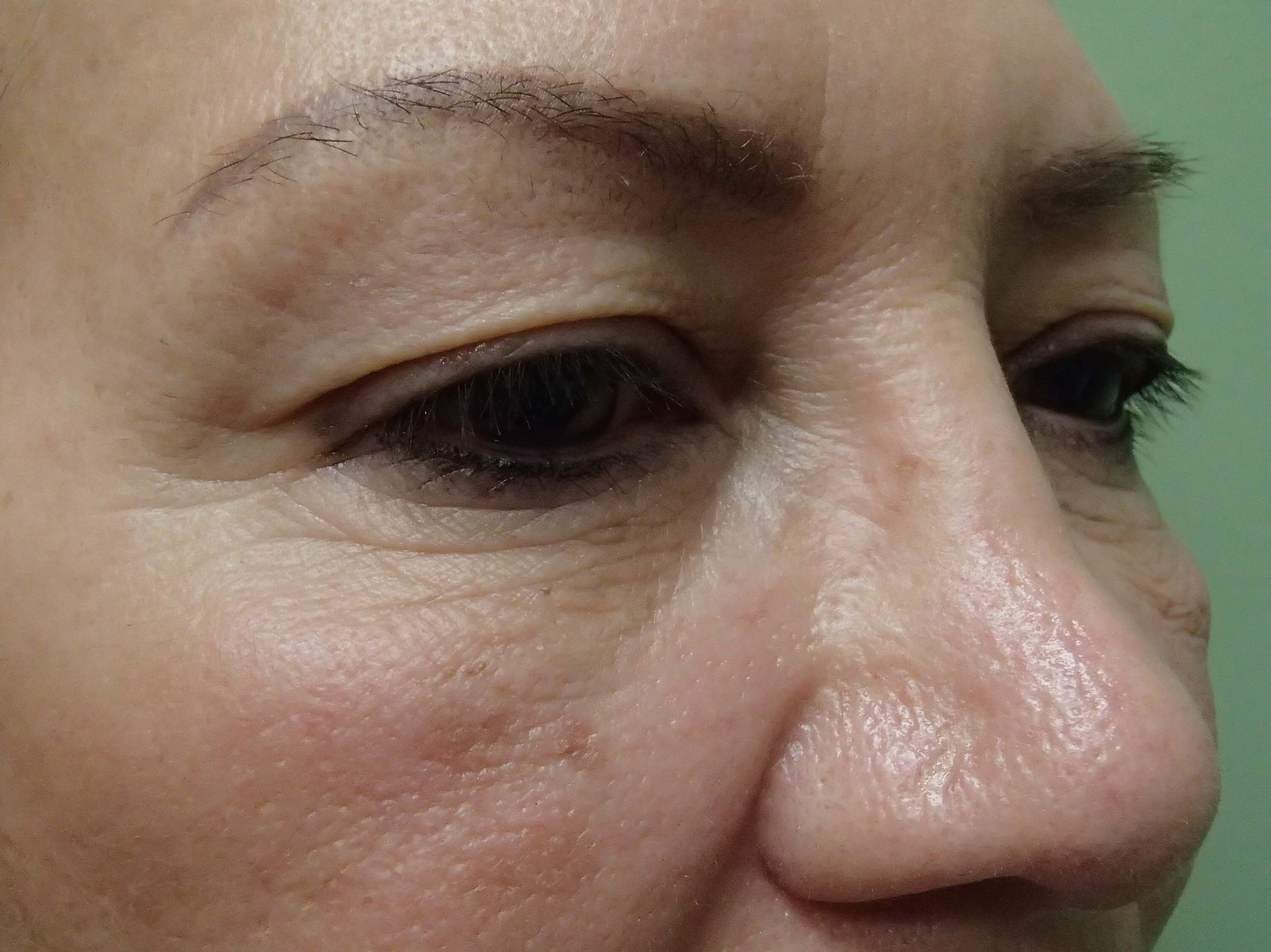 Before Image