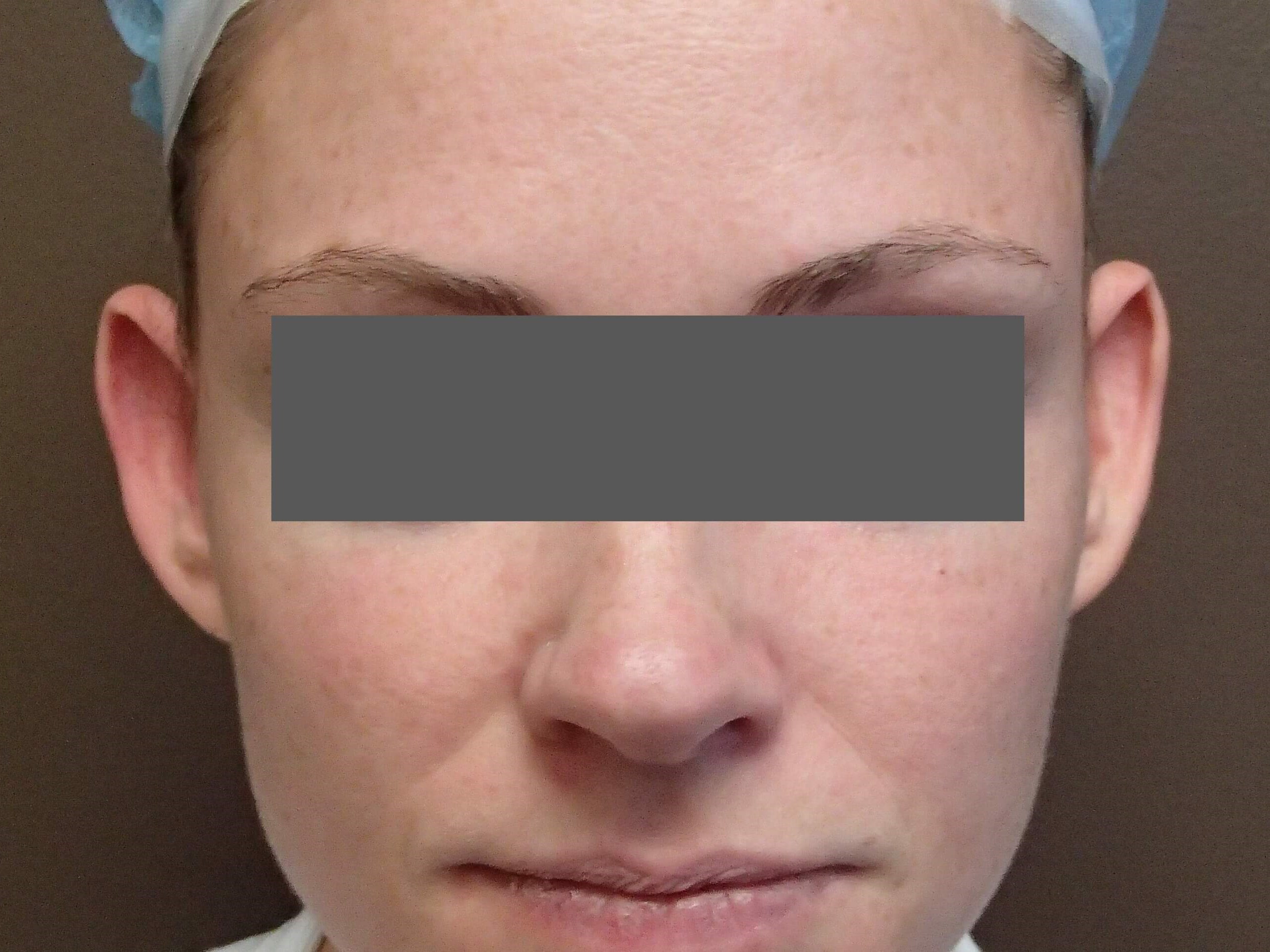 Before Image
