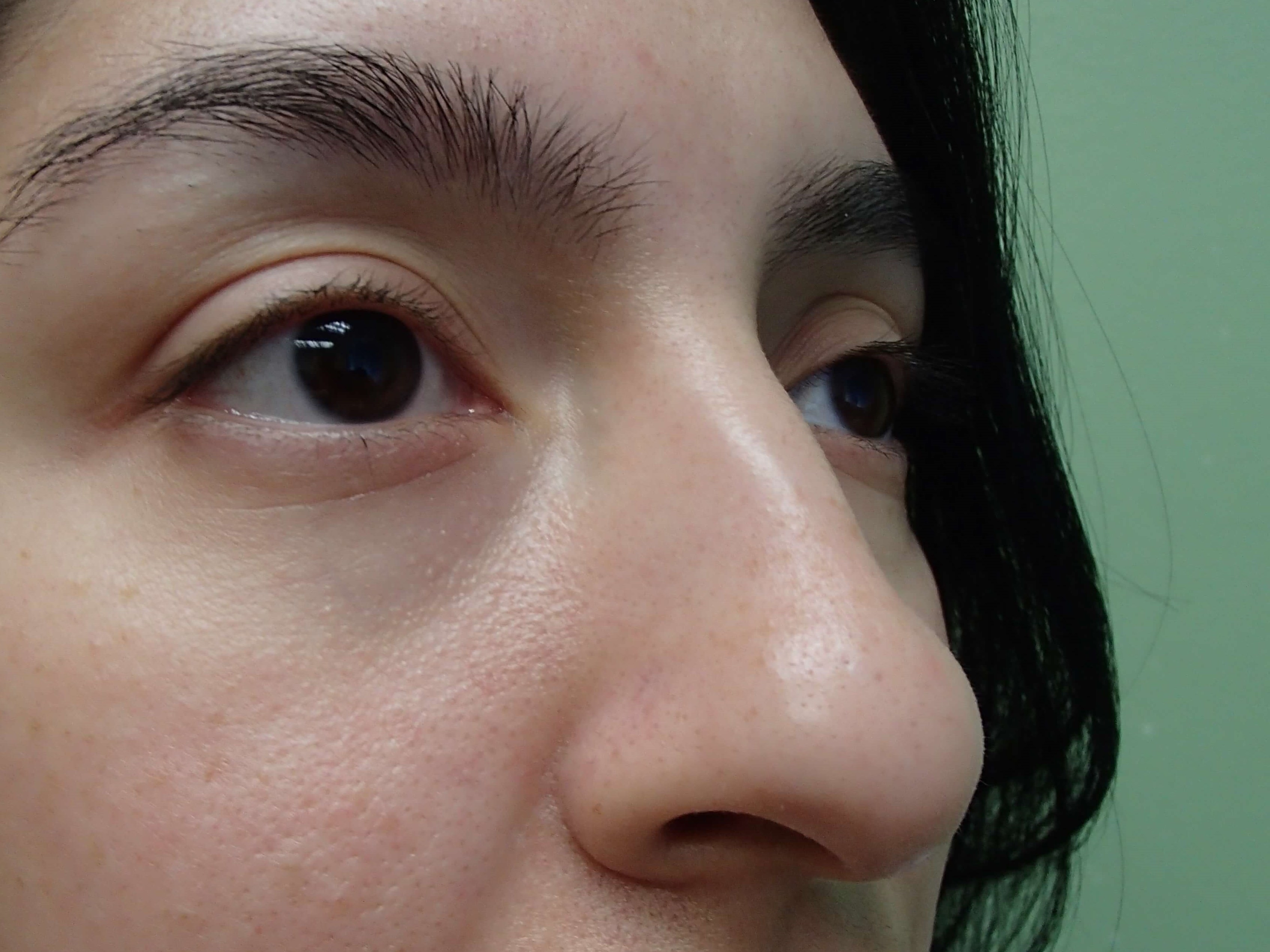 Before Image
