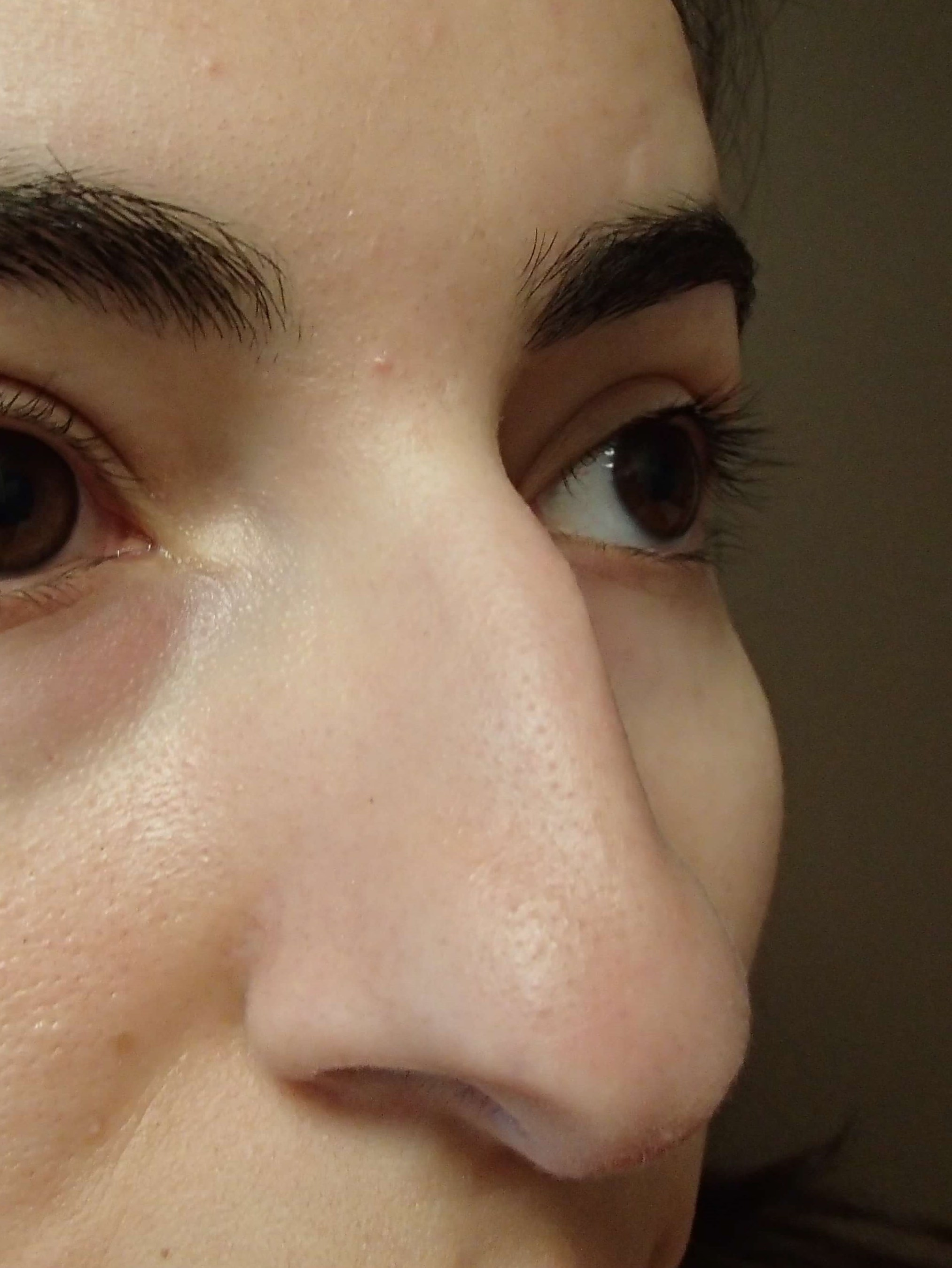 Before Image