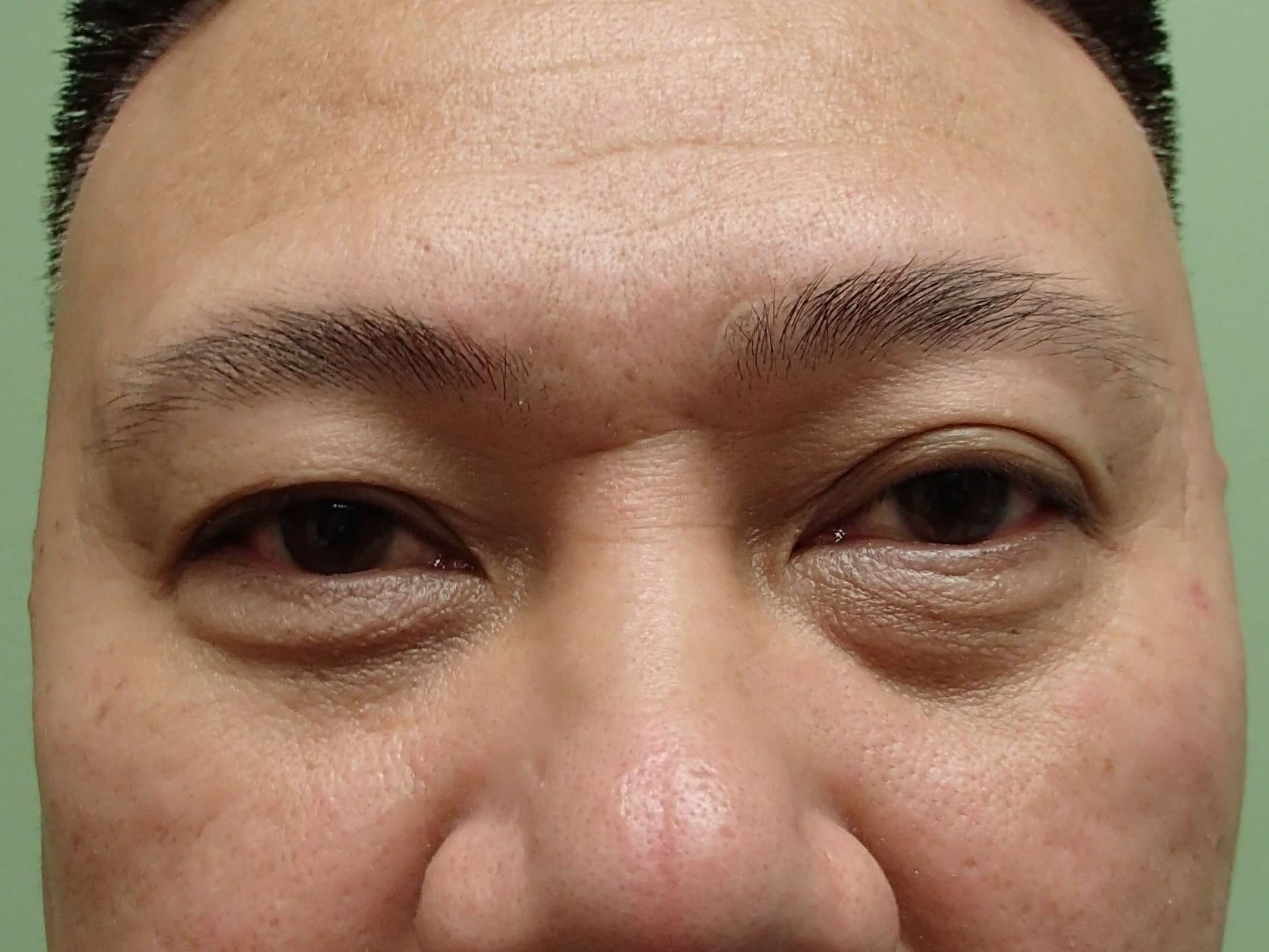 Before Image
