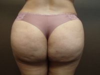 After Image