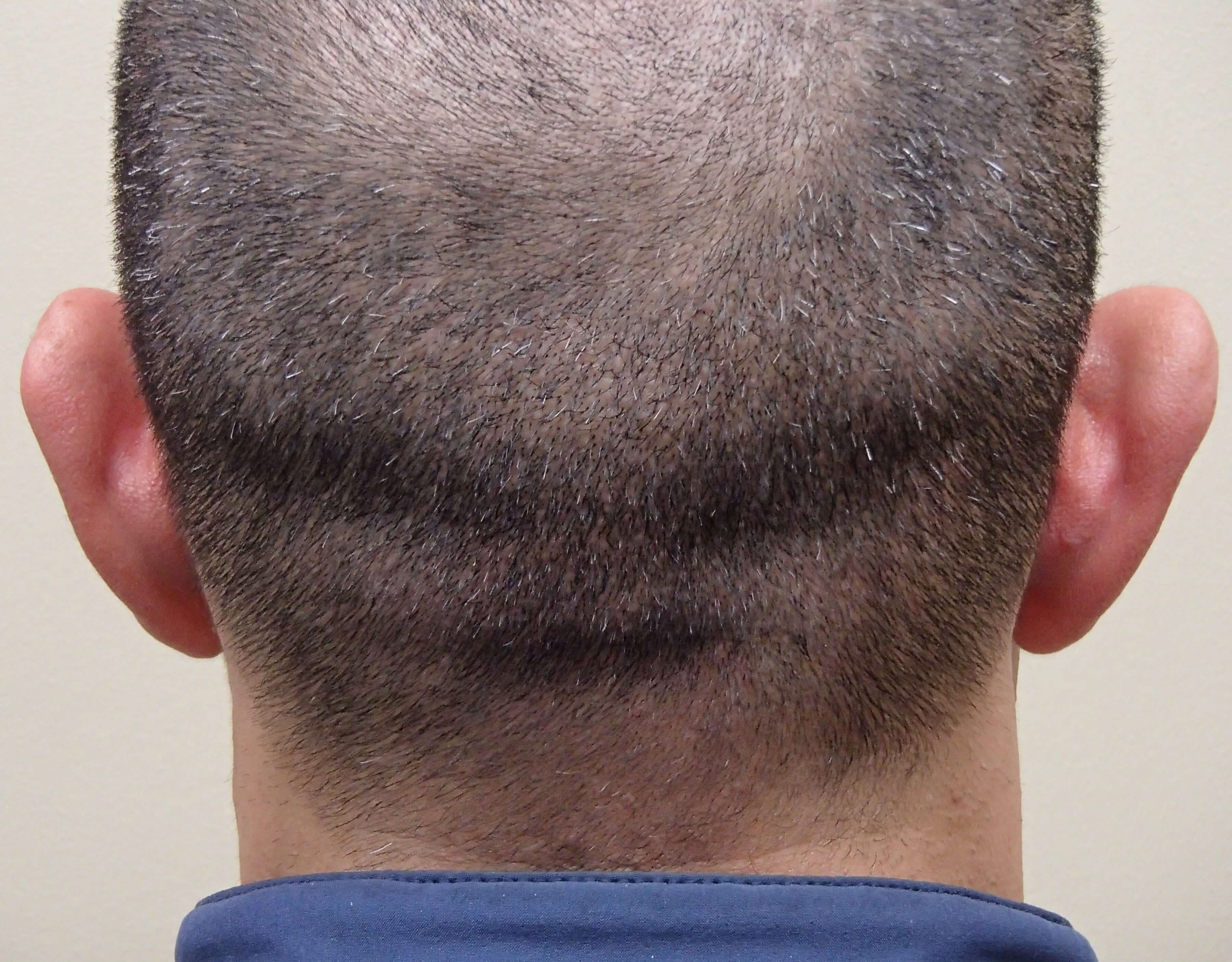 Before Image