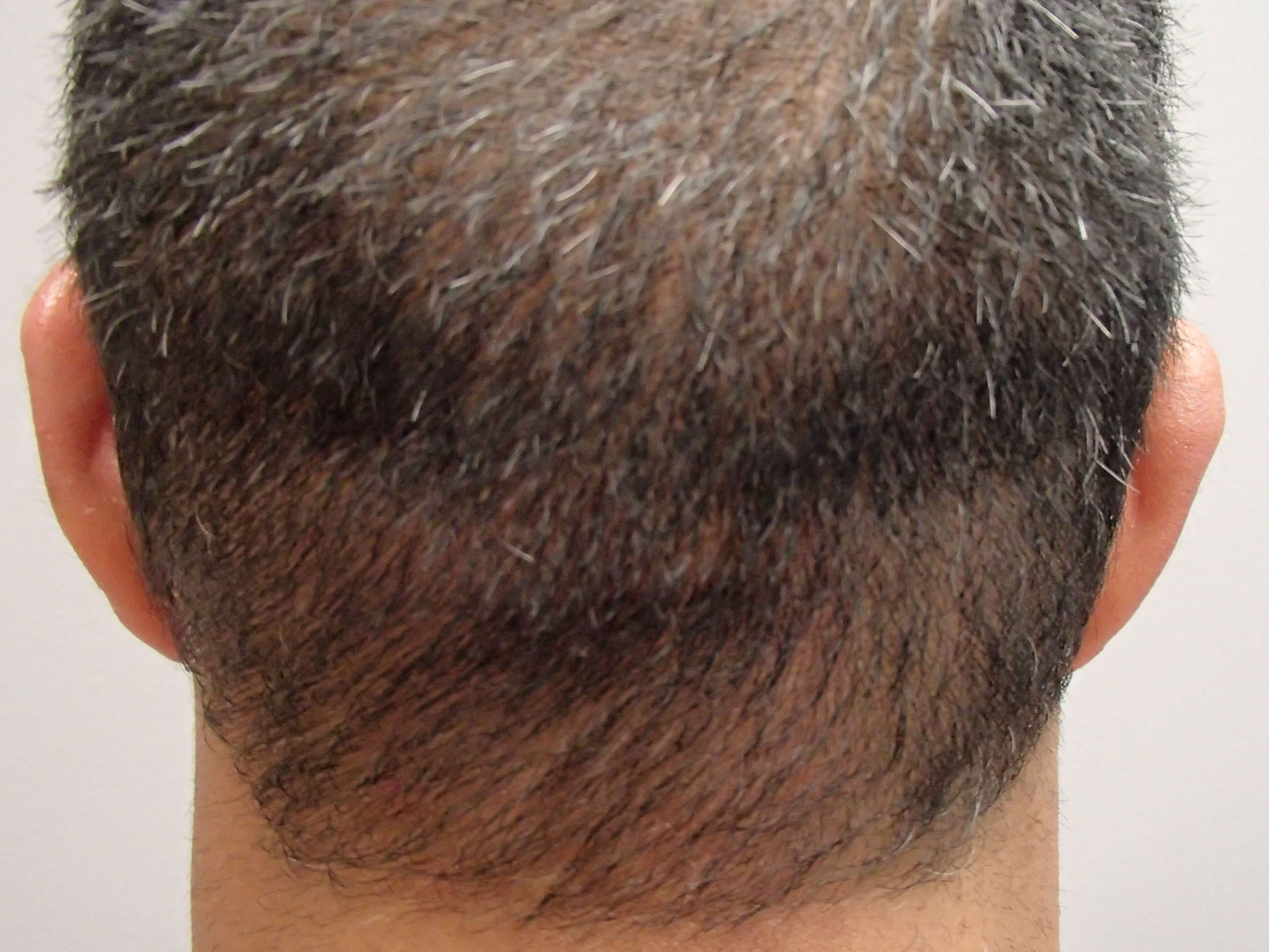 After Image