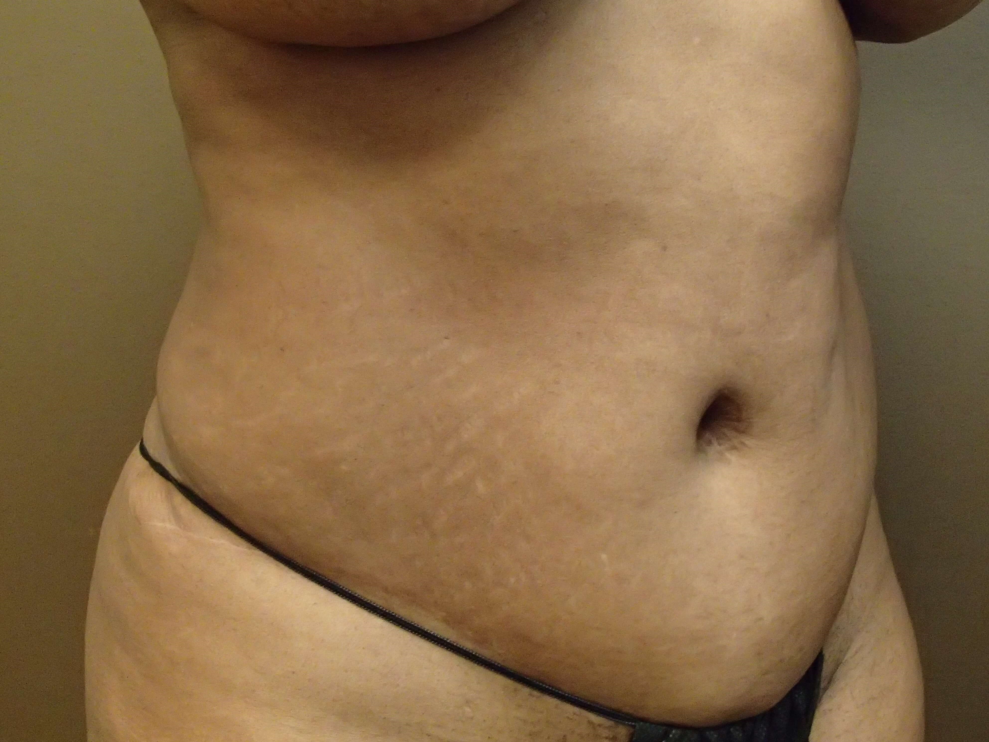 Before Image