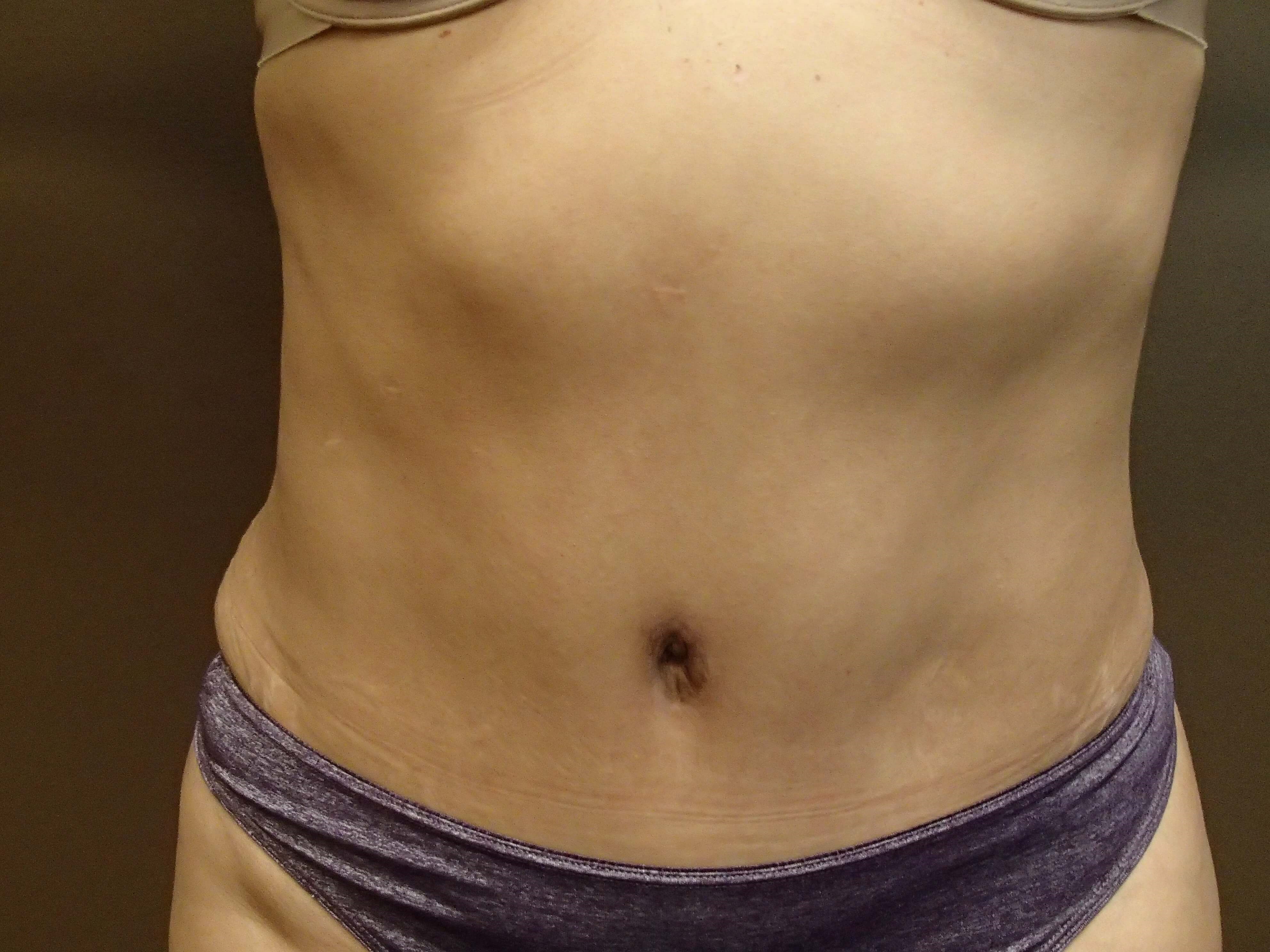 Timeless Tuck After