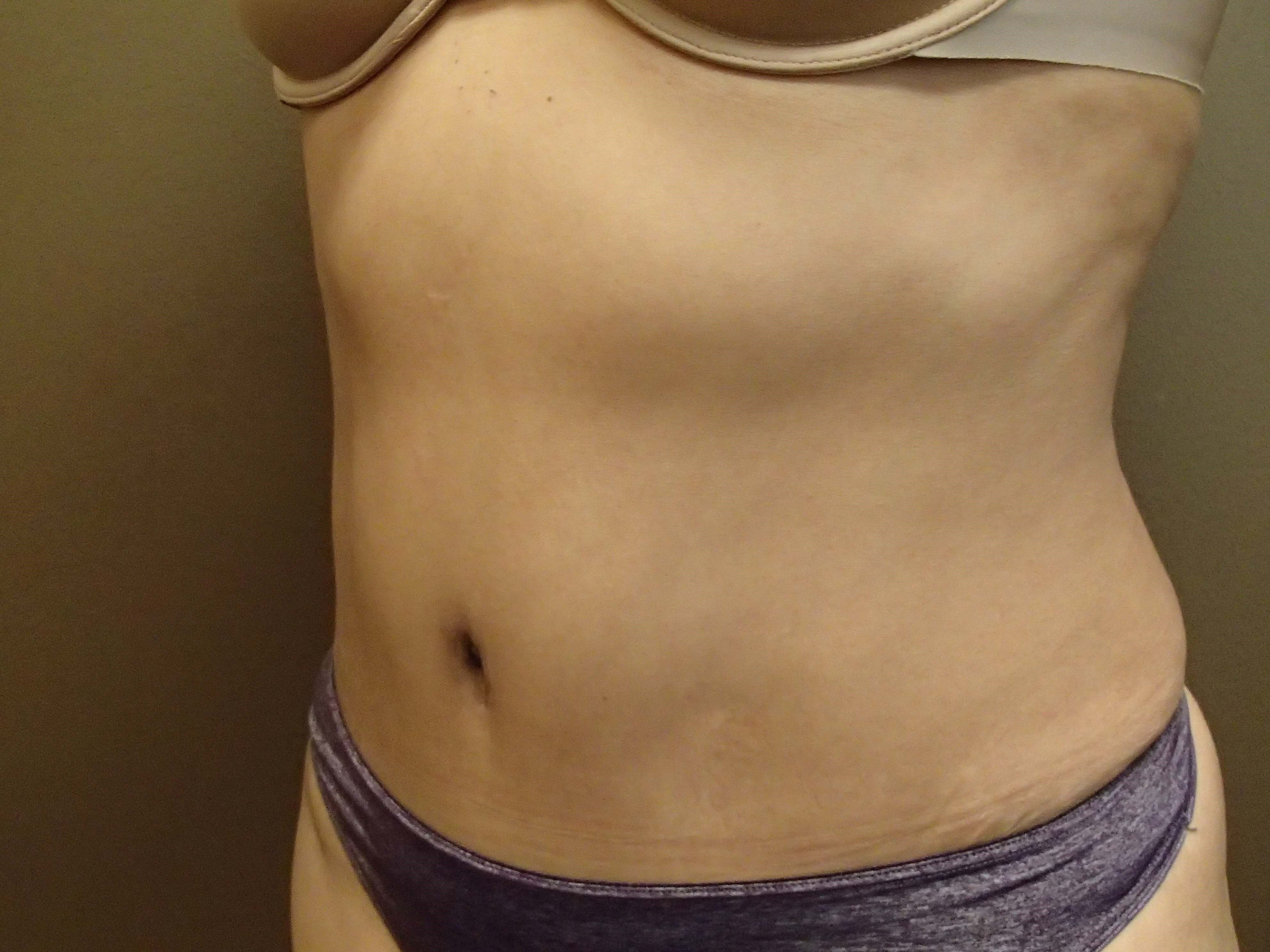 Timeless Tuck After