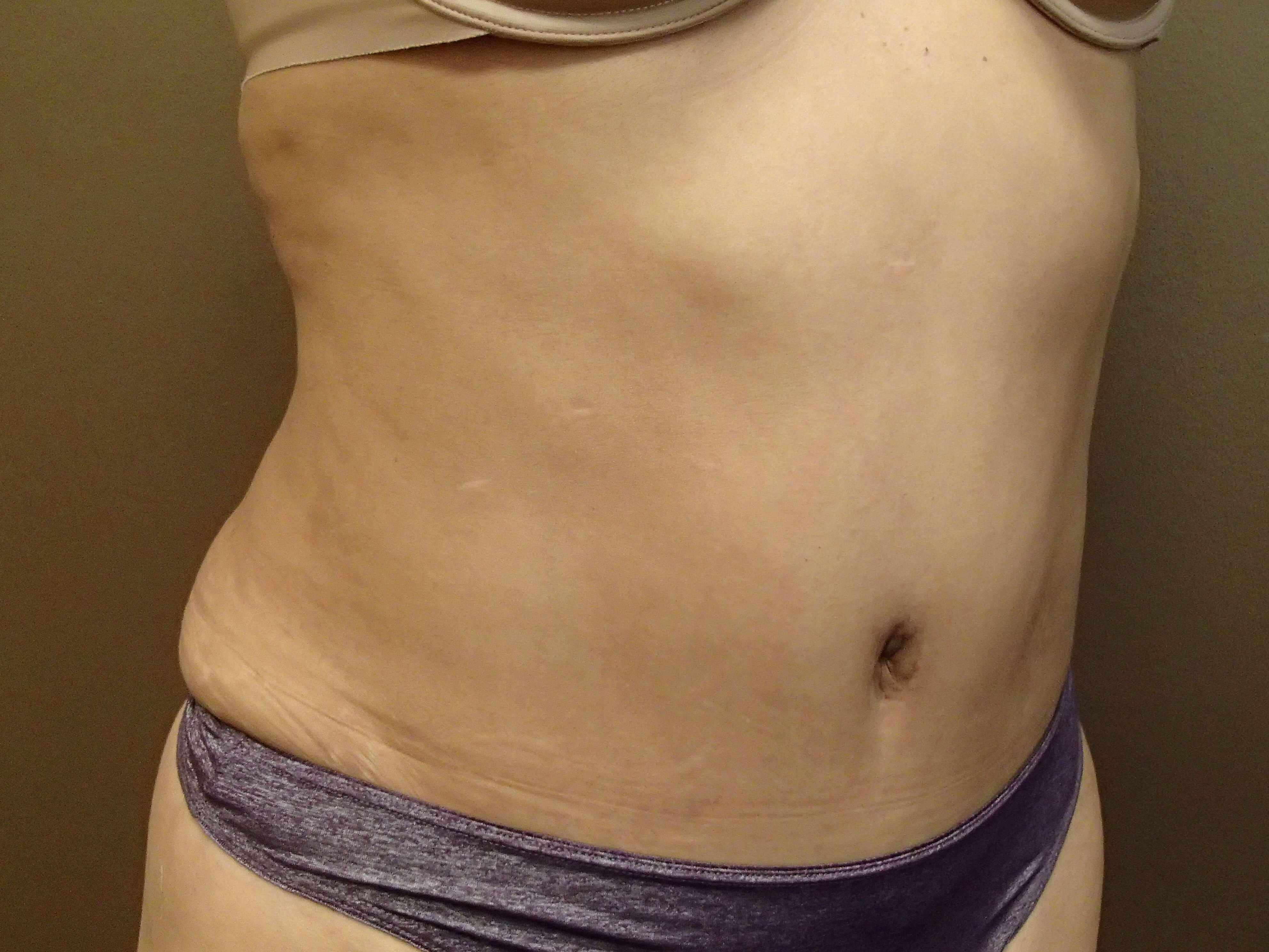 Timeless Tuck After