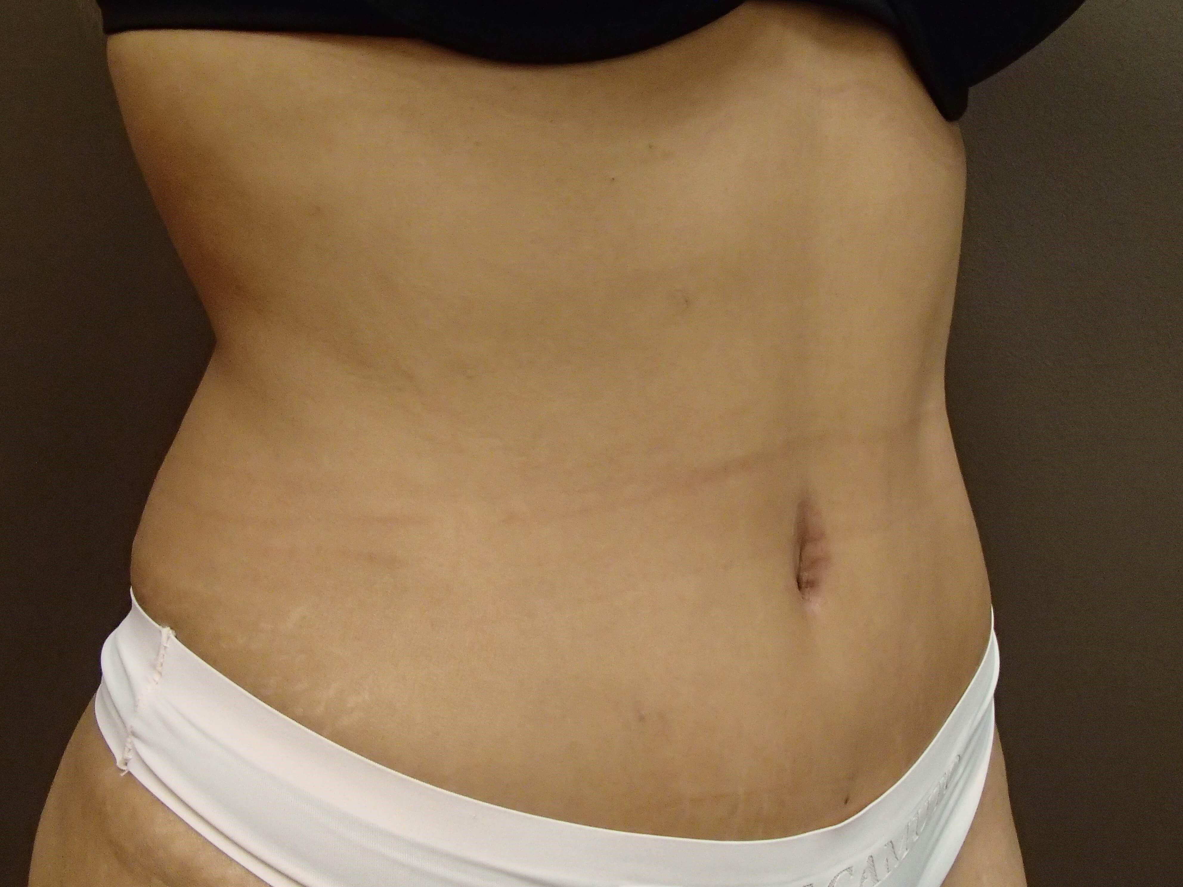 Timeless Tuck After